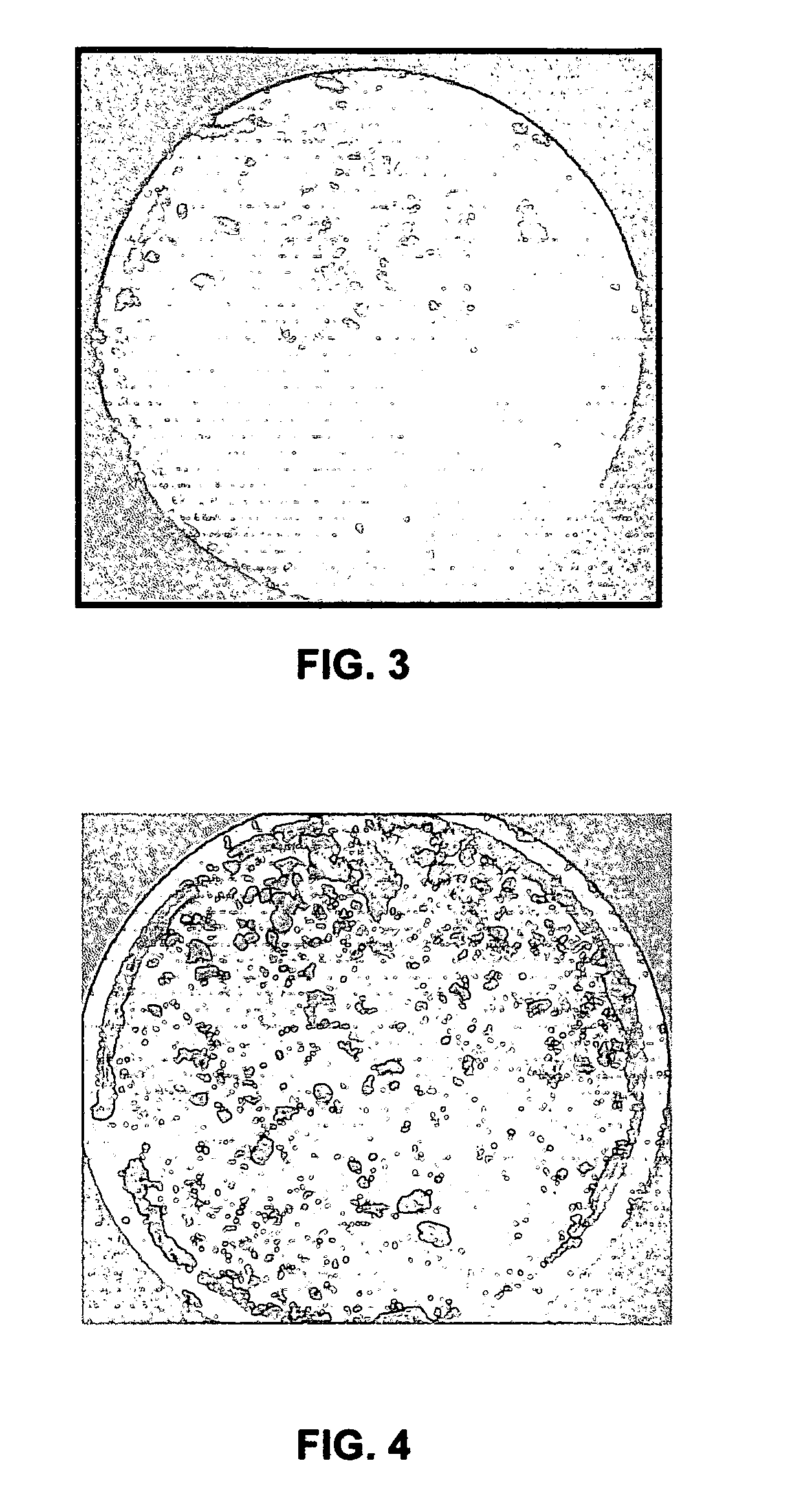 Method of removing an invert emulsion filter cake after the drilling process using a single phase microemulsion