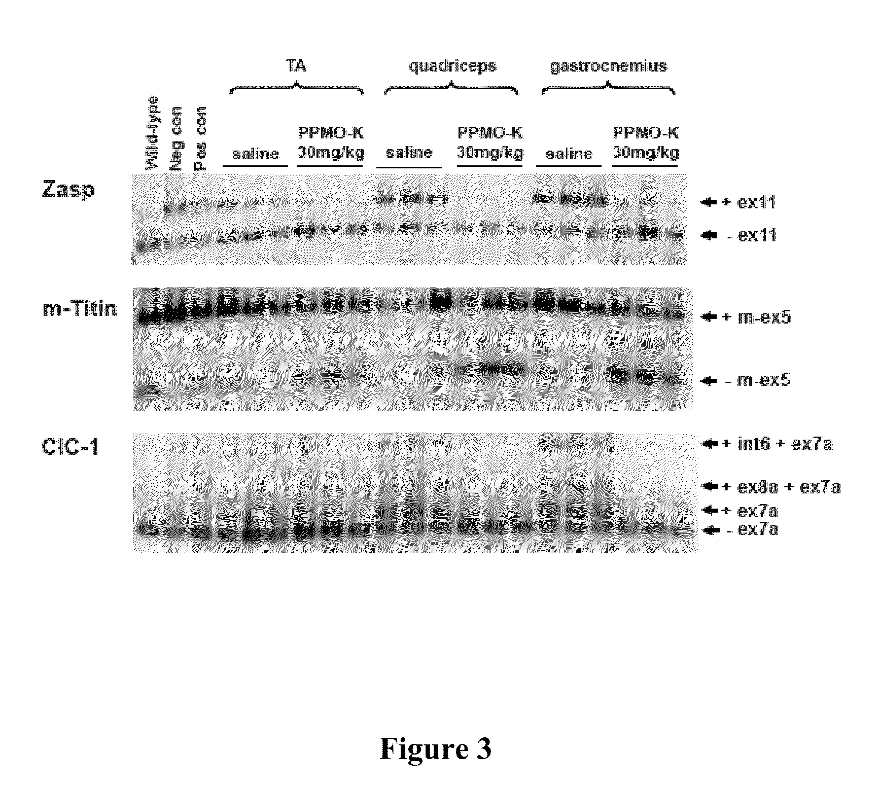 Peptide-linked morpholino antisense oligonucleotides for treatment of myotonic dystrophy