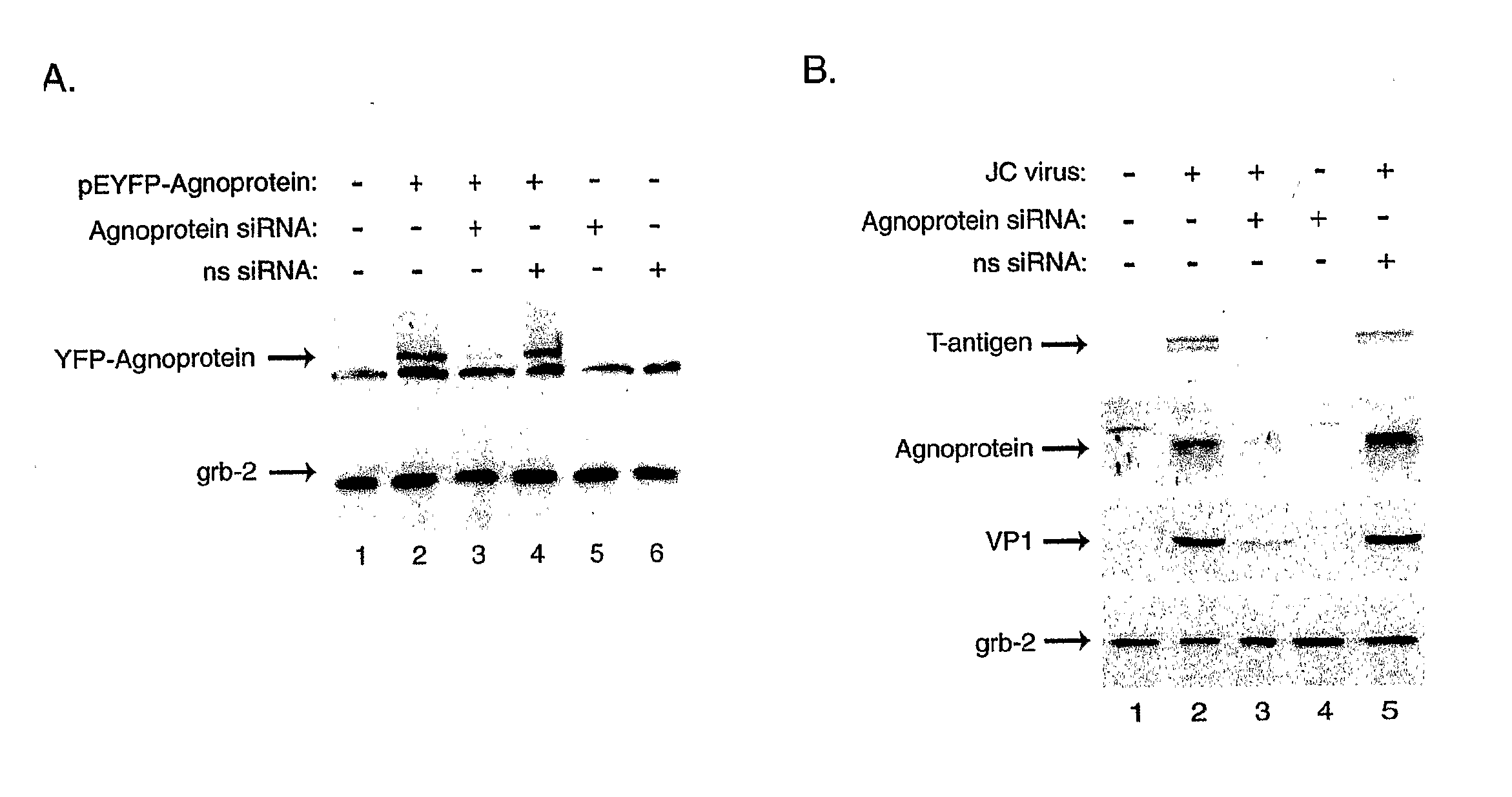 Compositions and Methods for Sirna Inhibition of Primate Polyomavirus Genes