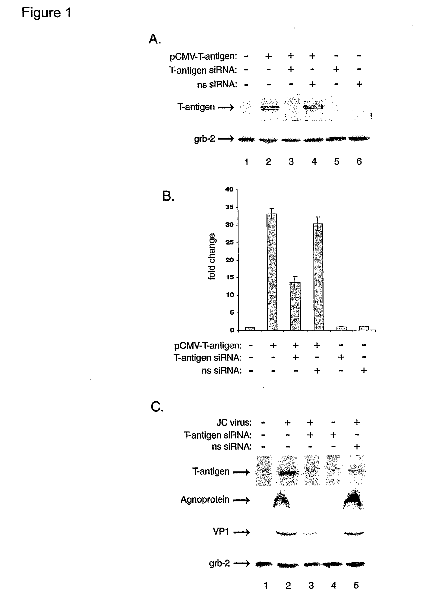 Compositions and Methods for Sirna Inhibition of Primate Polyomavirus Genes