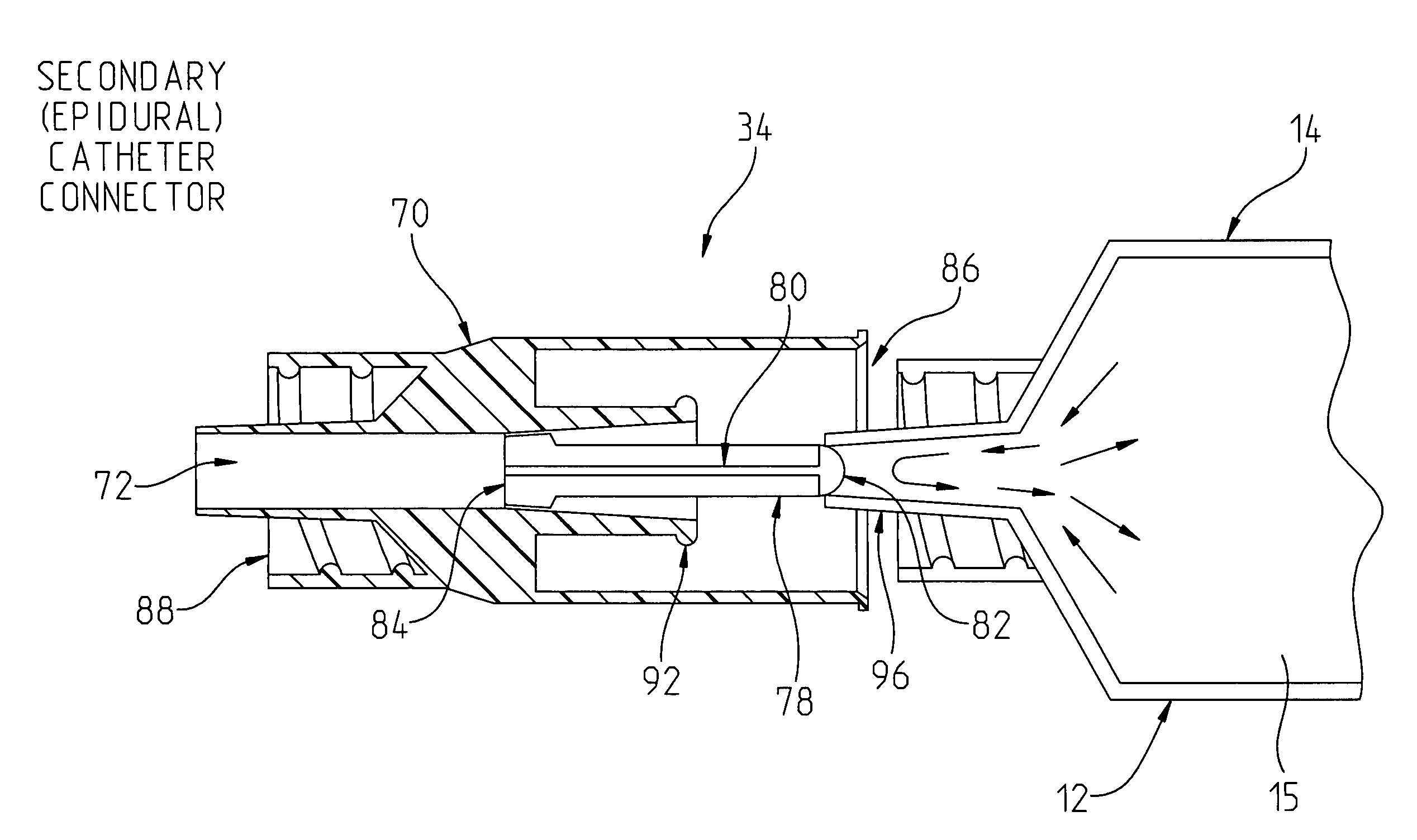 Epidural anesthetic delivery system