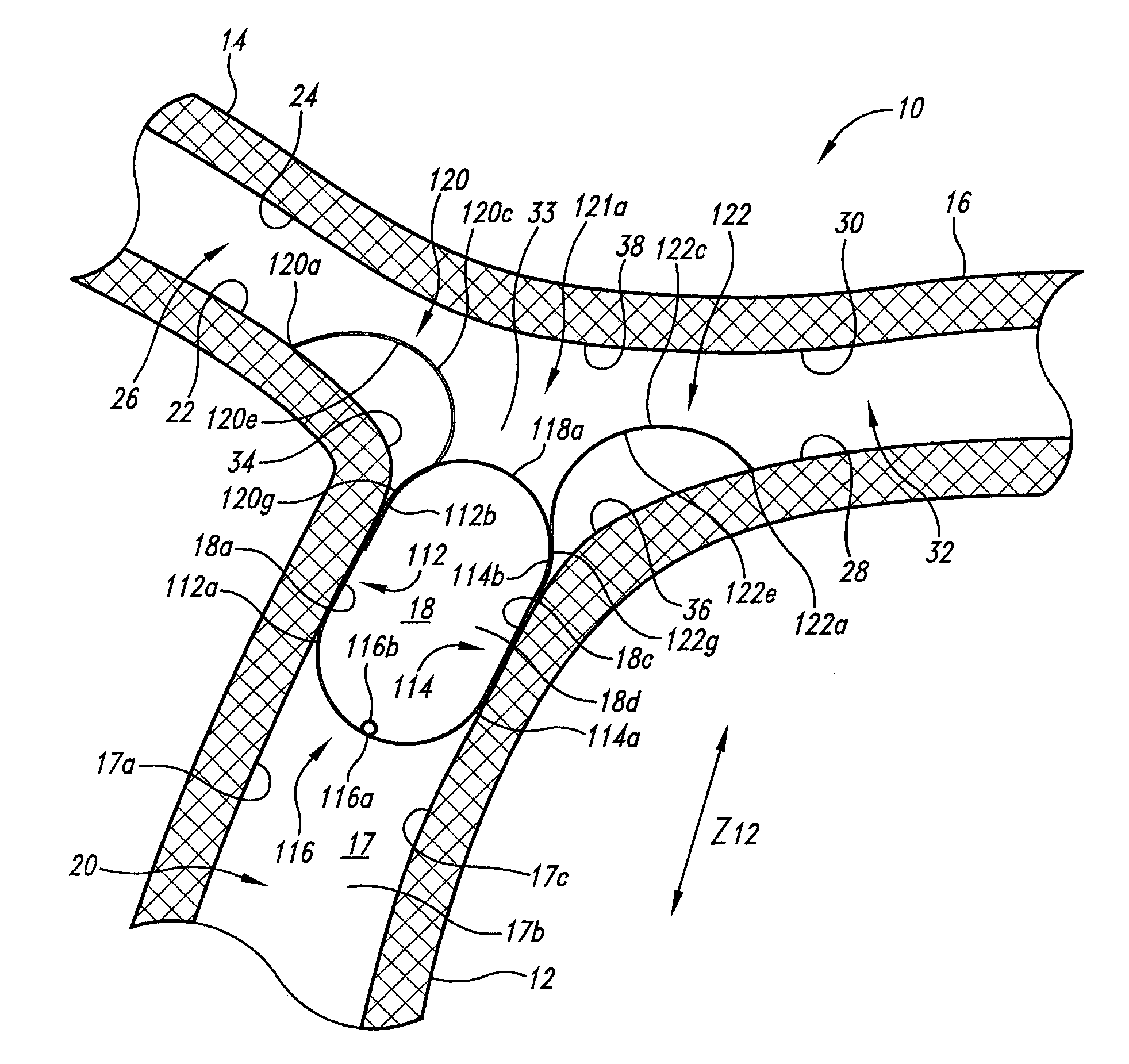 Vascular anchor tethering system and method