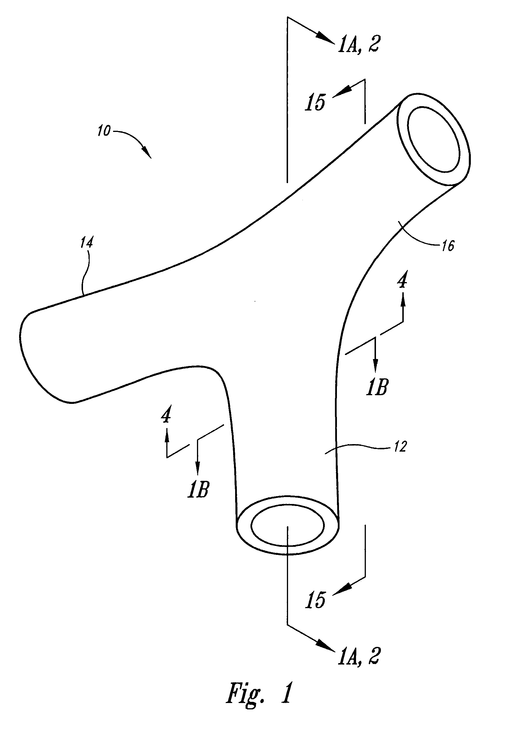 Vascular anchor tethering system and method