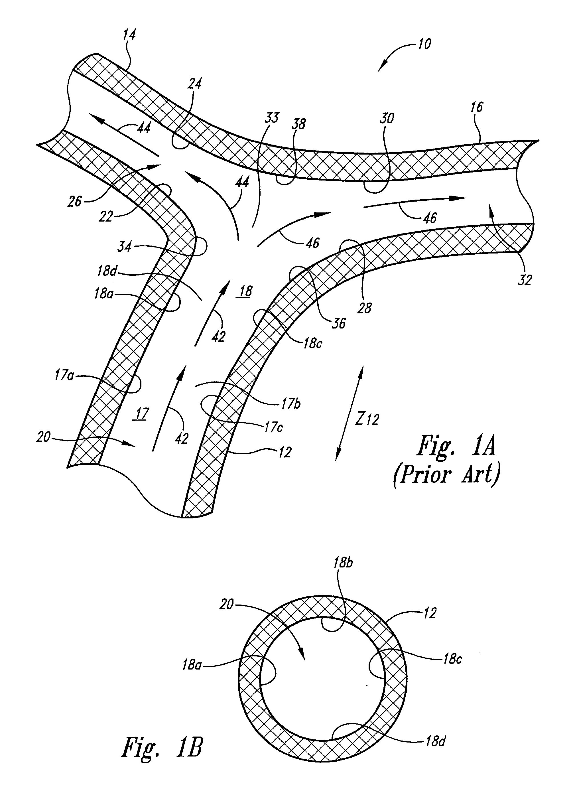 Vascular anchor tethering system and method