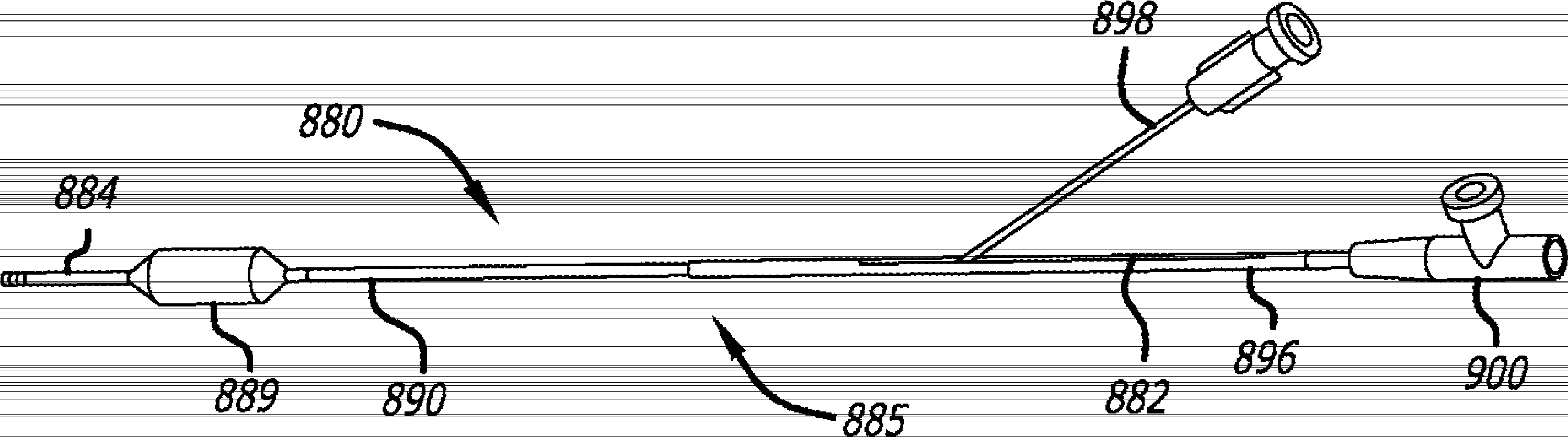 Methods and apparatus for treating disorders of the ear nose and throat