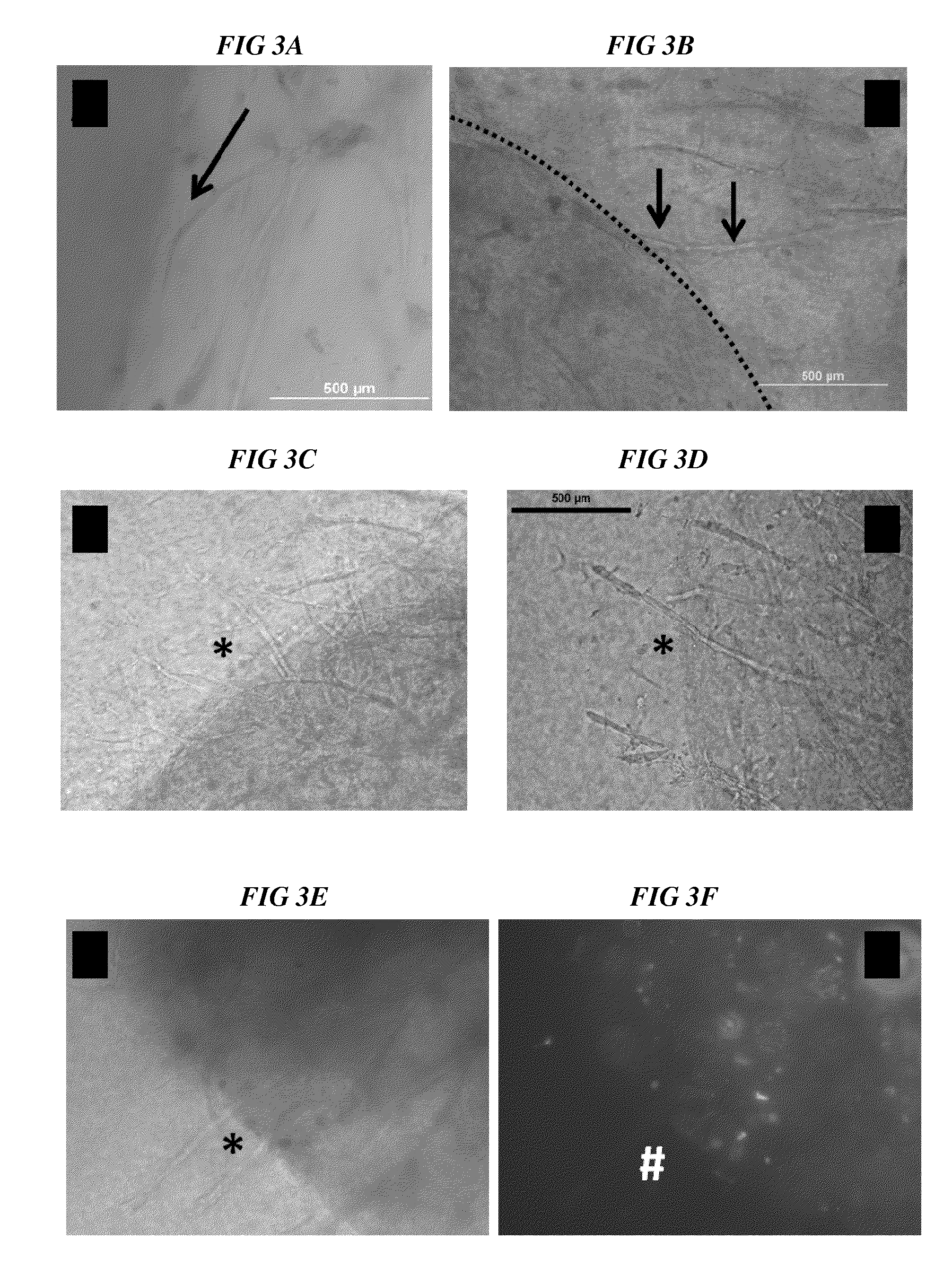 Methods and compositions to support tissue integration and inosculation of transplanted tissue and transplanted engineered penile tissue with adipose stromal cells