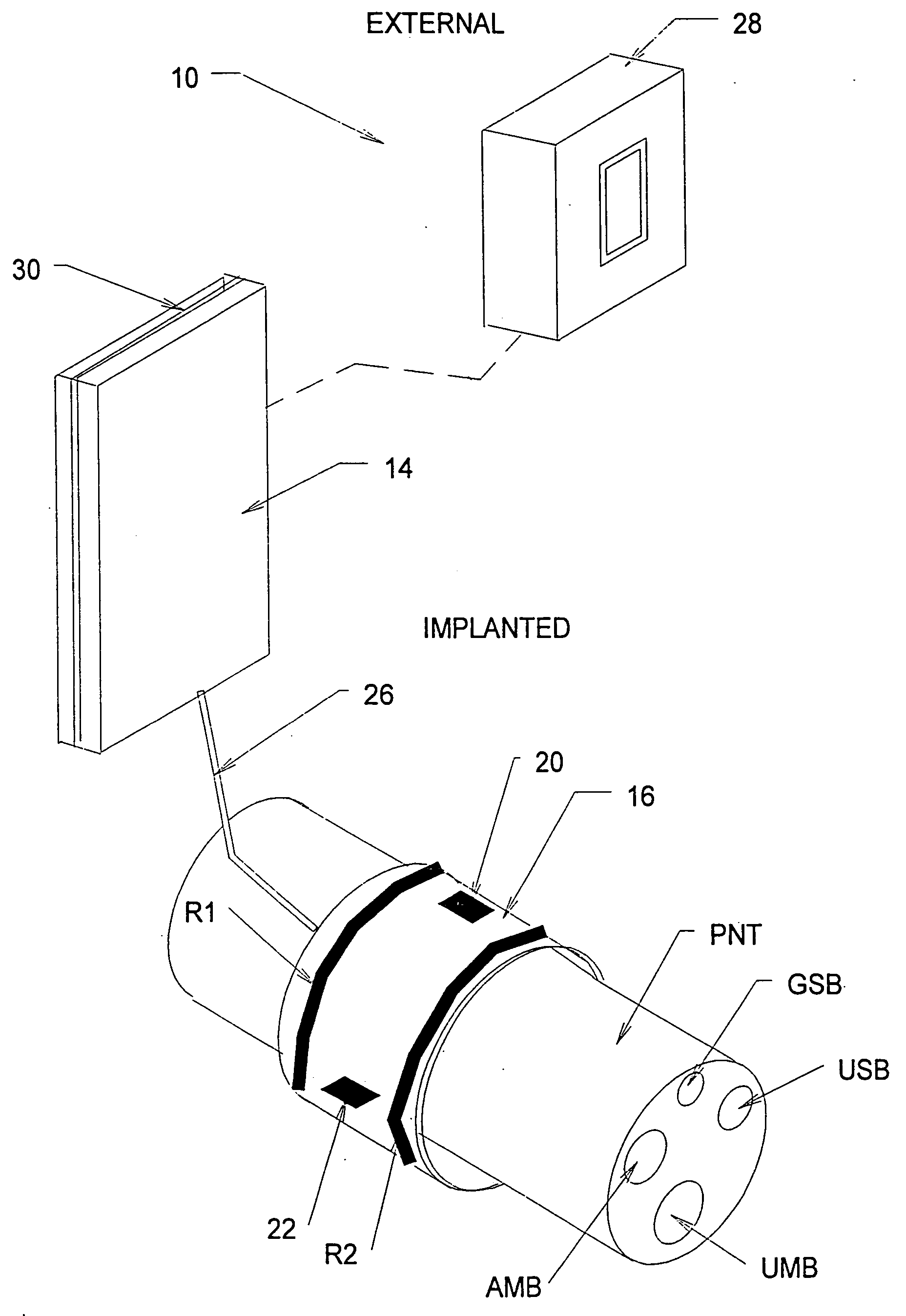 Systems and methods for selectively stimulating components in, on, or near the pudendal nerve or its branches to achieve selective physiologic responses