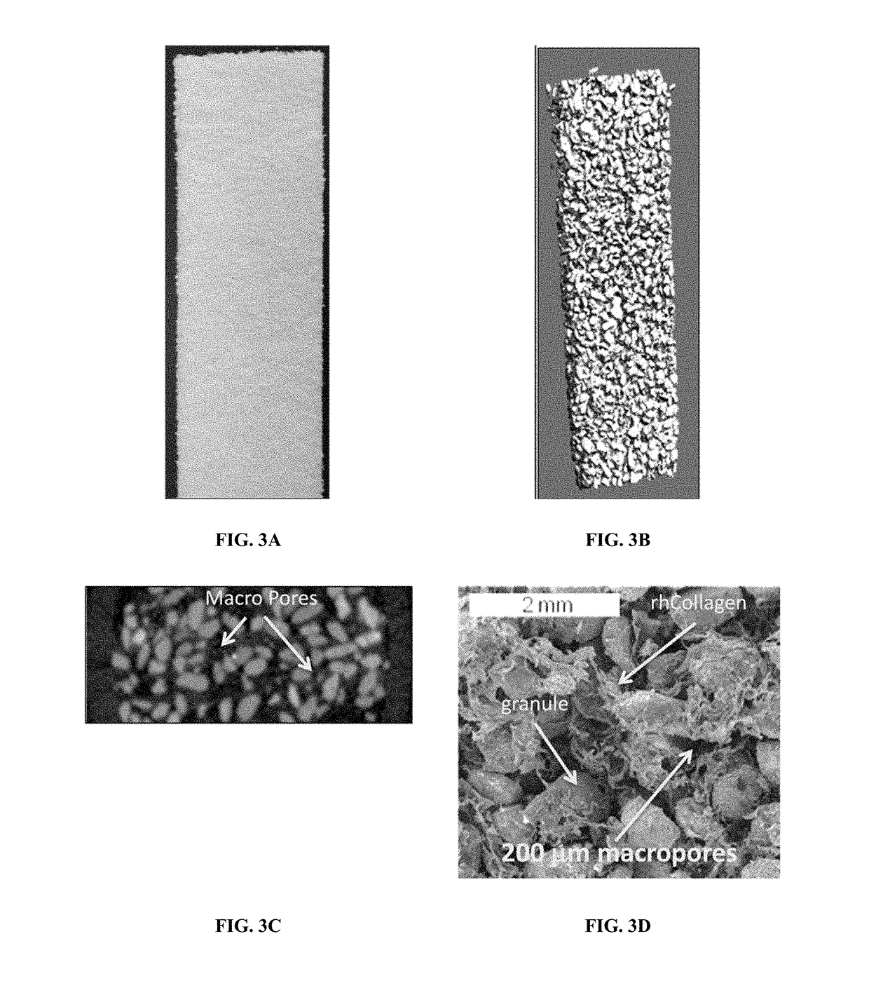 Composite matrices designed for enhanced bone repair