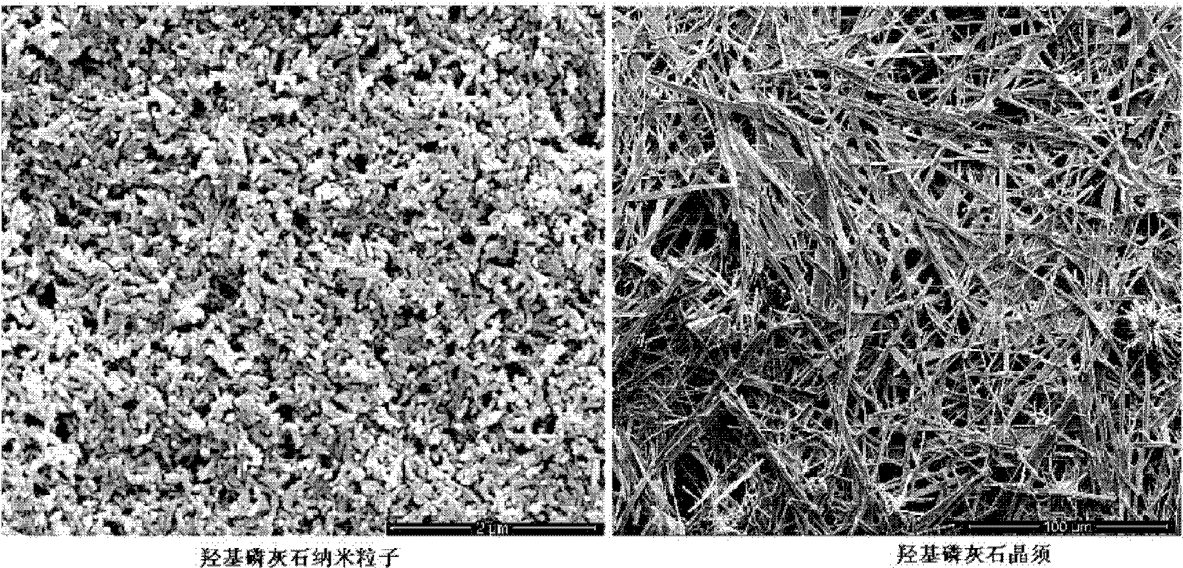 Composite material used for interbody fusion cage and its preparation method