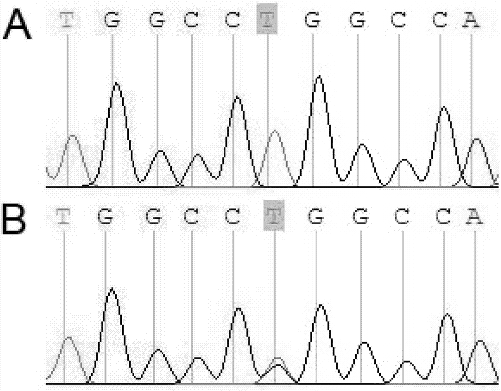 Application of AQP5 gene in preparation and detection of congenital cataract product