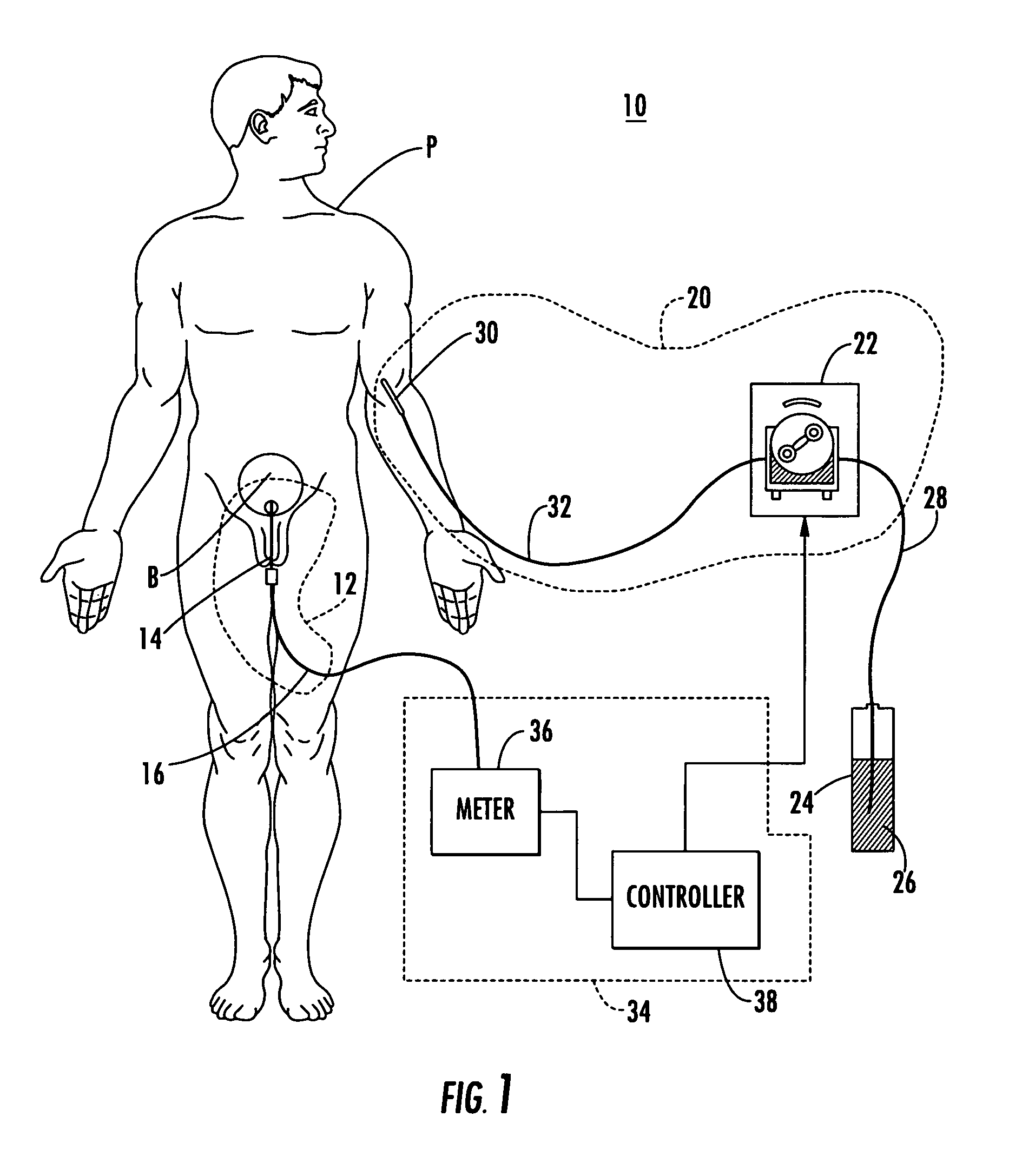 Patient hydration system with abnormal condition sensing