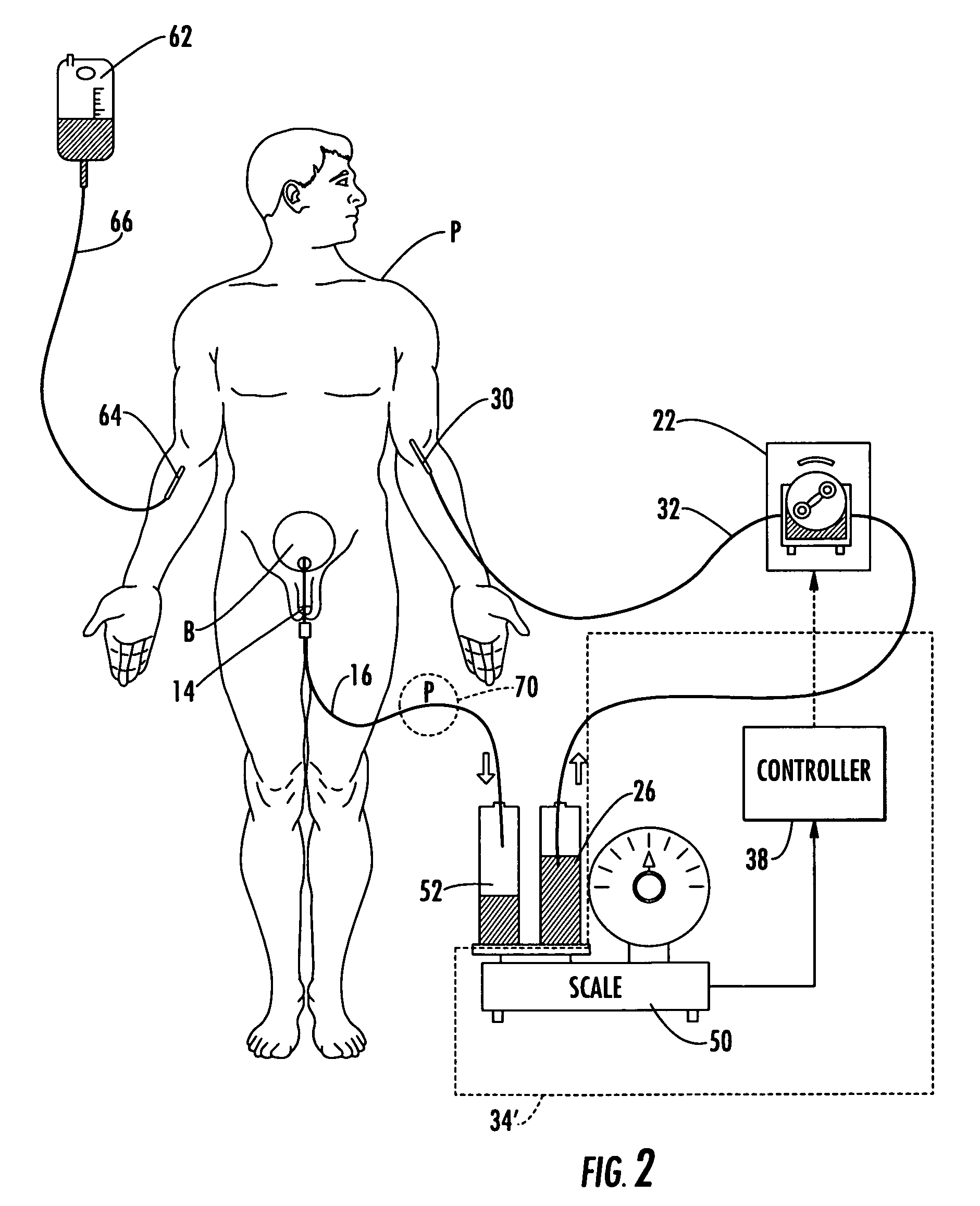 Patient hydration system with abnormal condition sensing