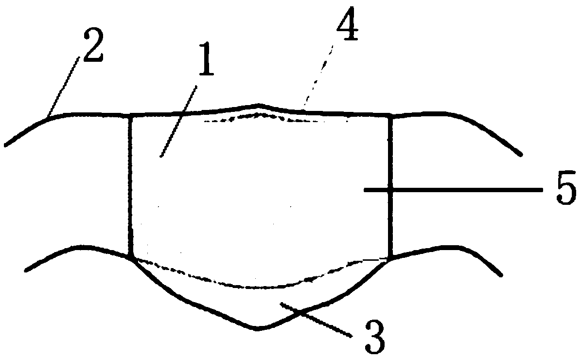 Antibacterial and environment-friendly mask containing zedoary oil nano-particle coating and preparation method thereof