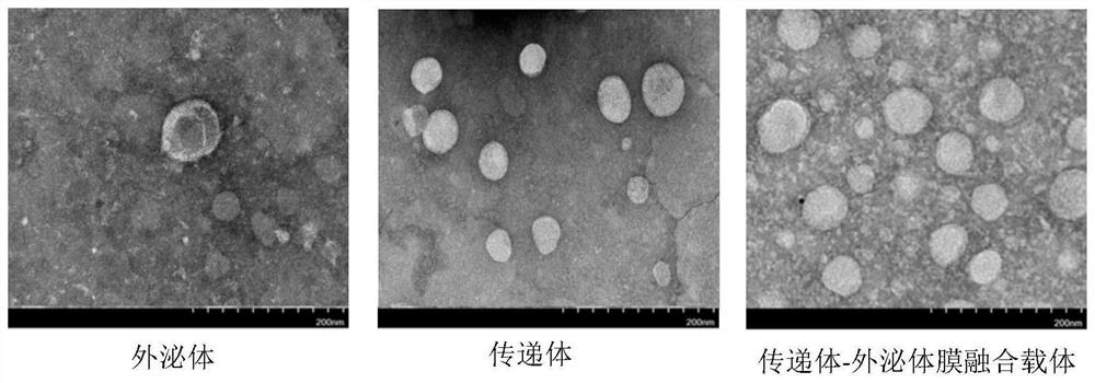 Transfersome-exosome membrane fusion preparation with transdermal enhancement effect as well as preparation method and application thereof