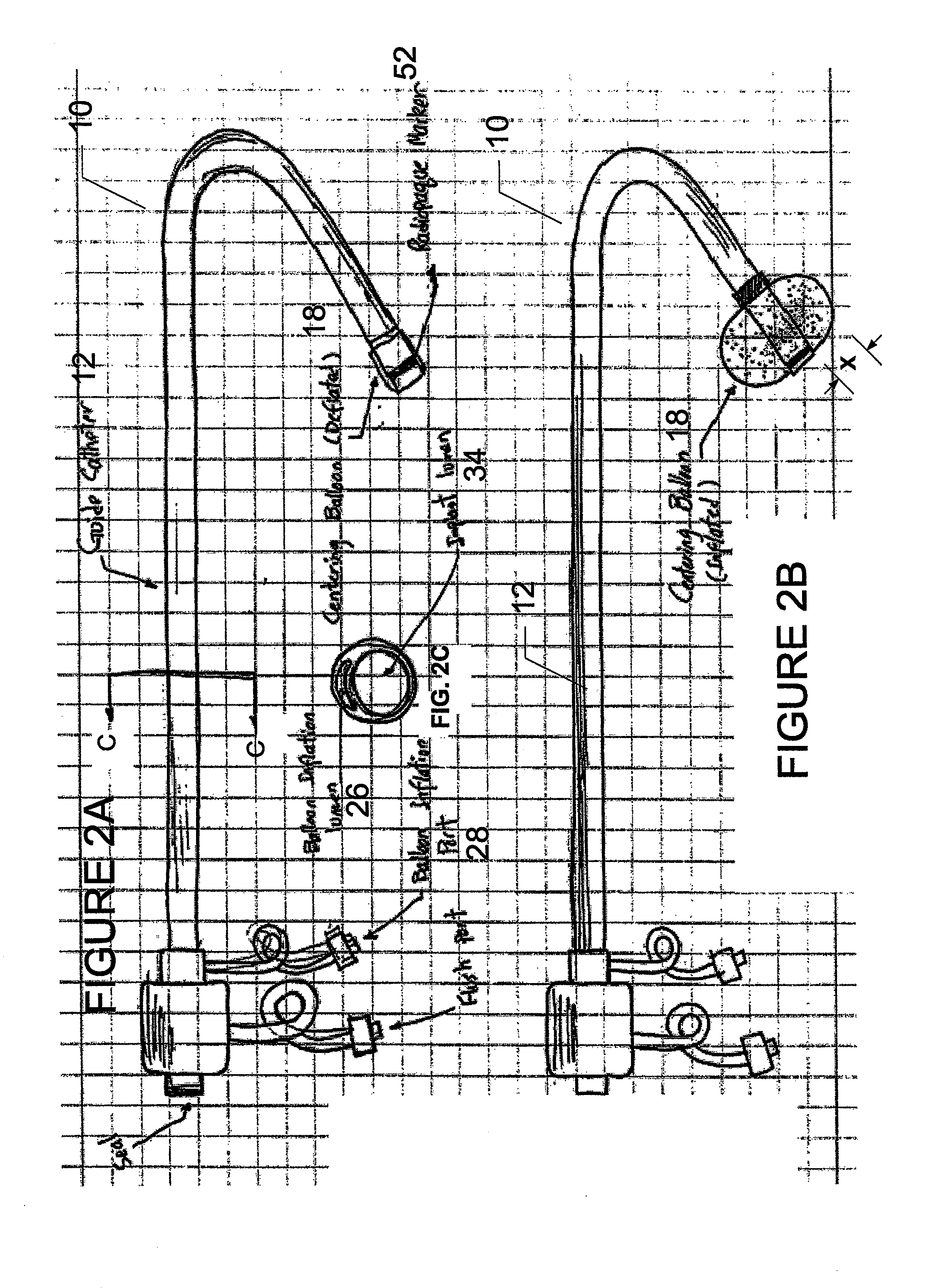 Devices and methods for delivering an endocardial device