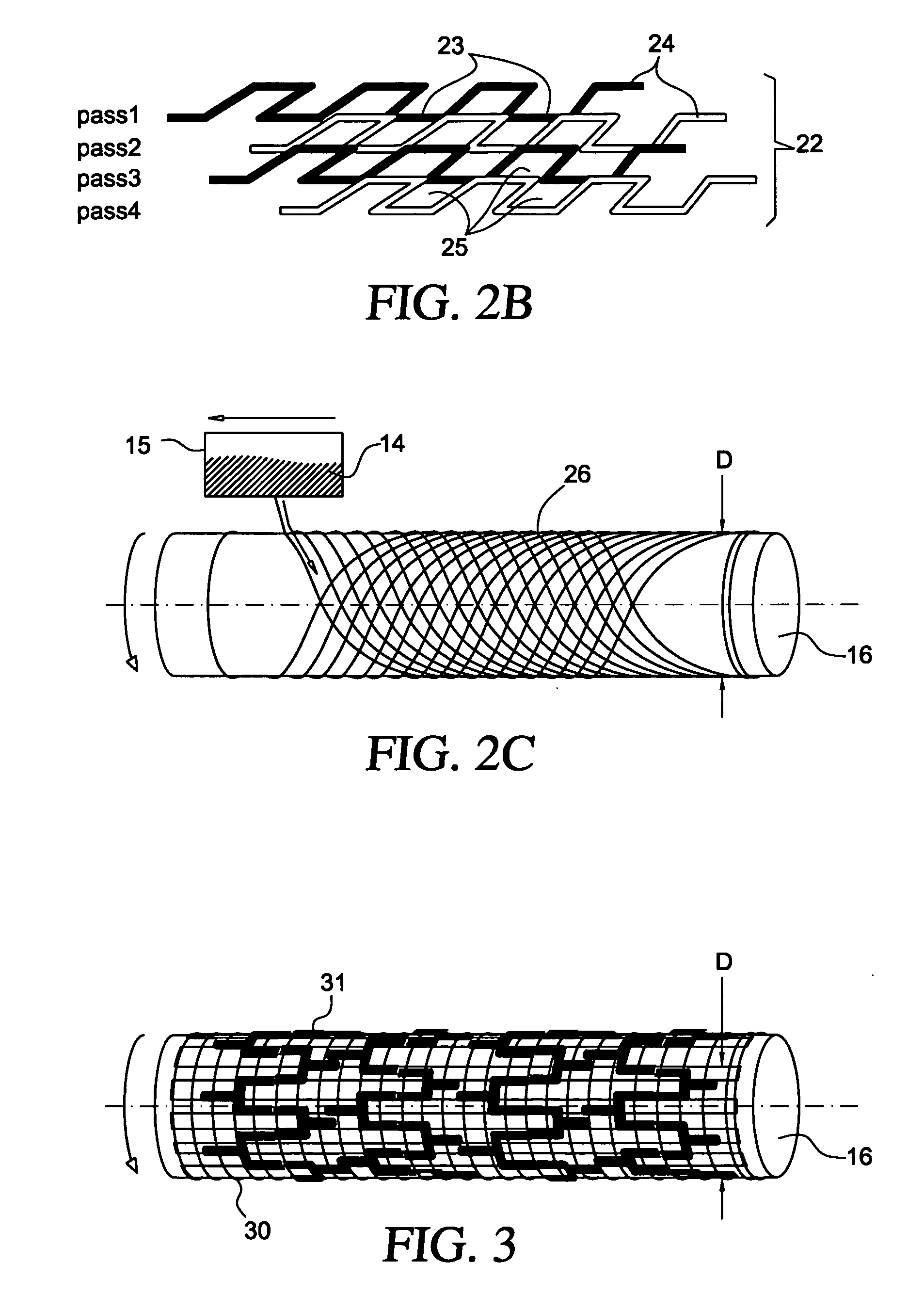Porous membranes for medical implants and methods of manufacture