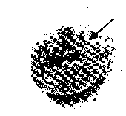 Application of radioisotope-labeled meso-position dianthrone compound in preparation of drug for detecting myocardial activity