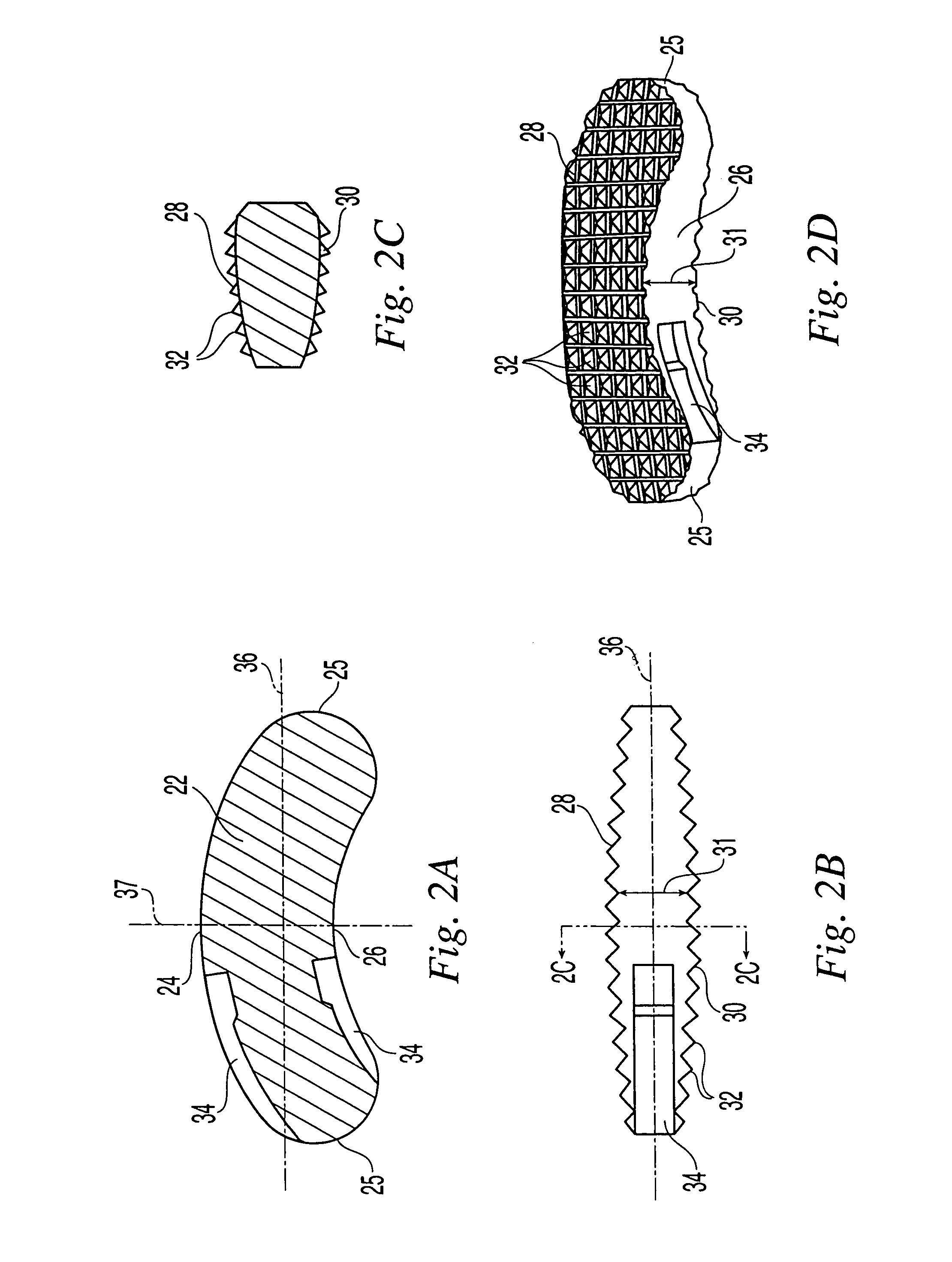 Method of performing a transforaminal posterior lumber interbody fusion procedure