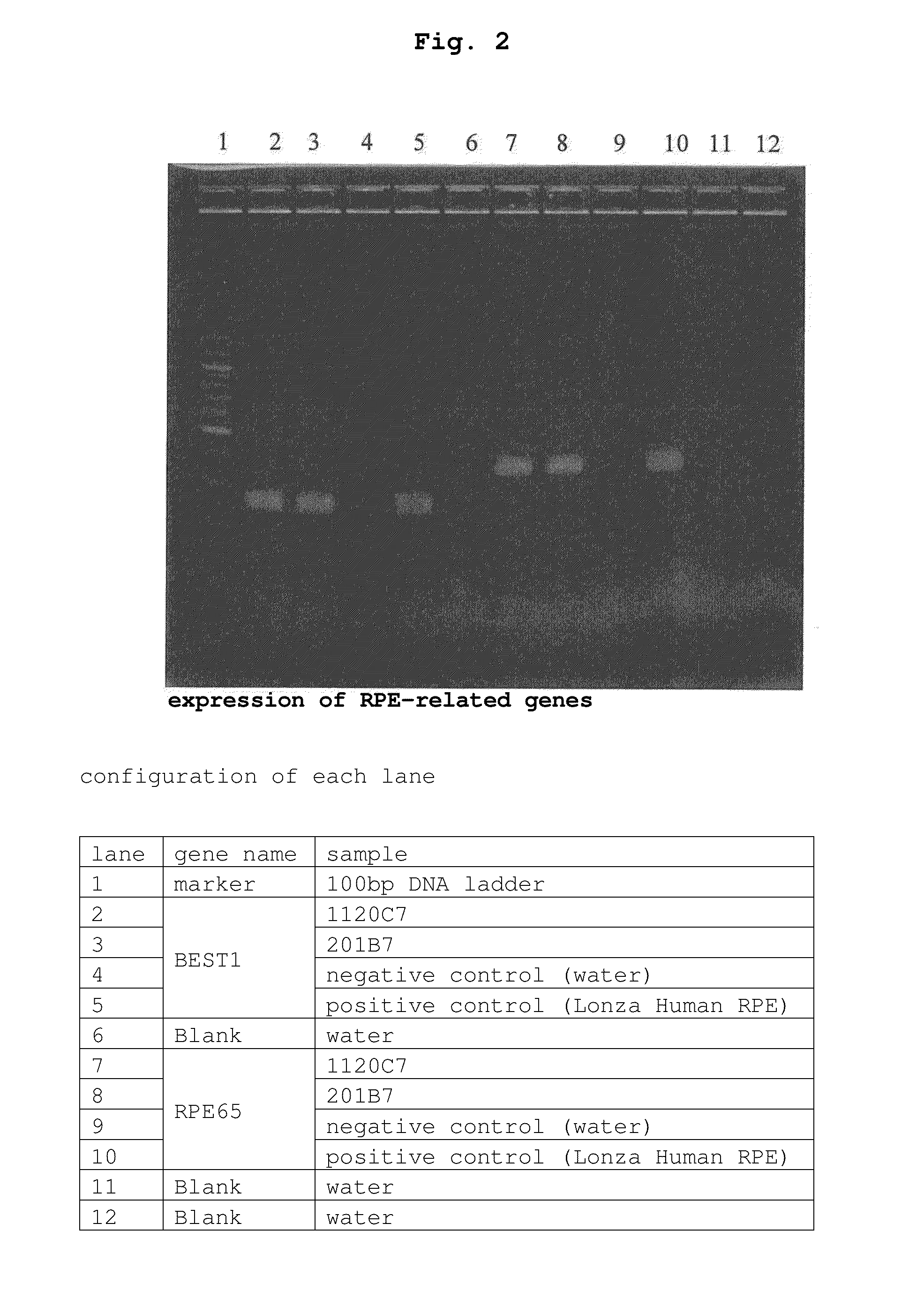 Method for purification of retinal pigment epithelial cells