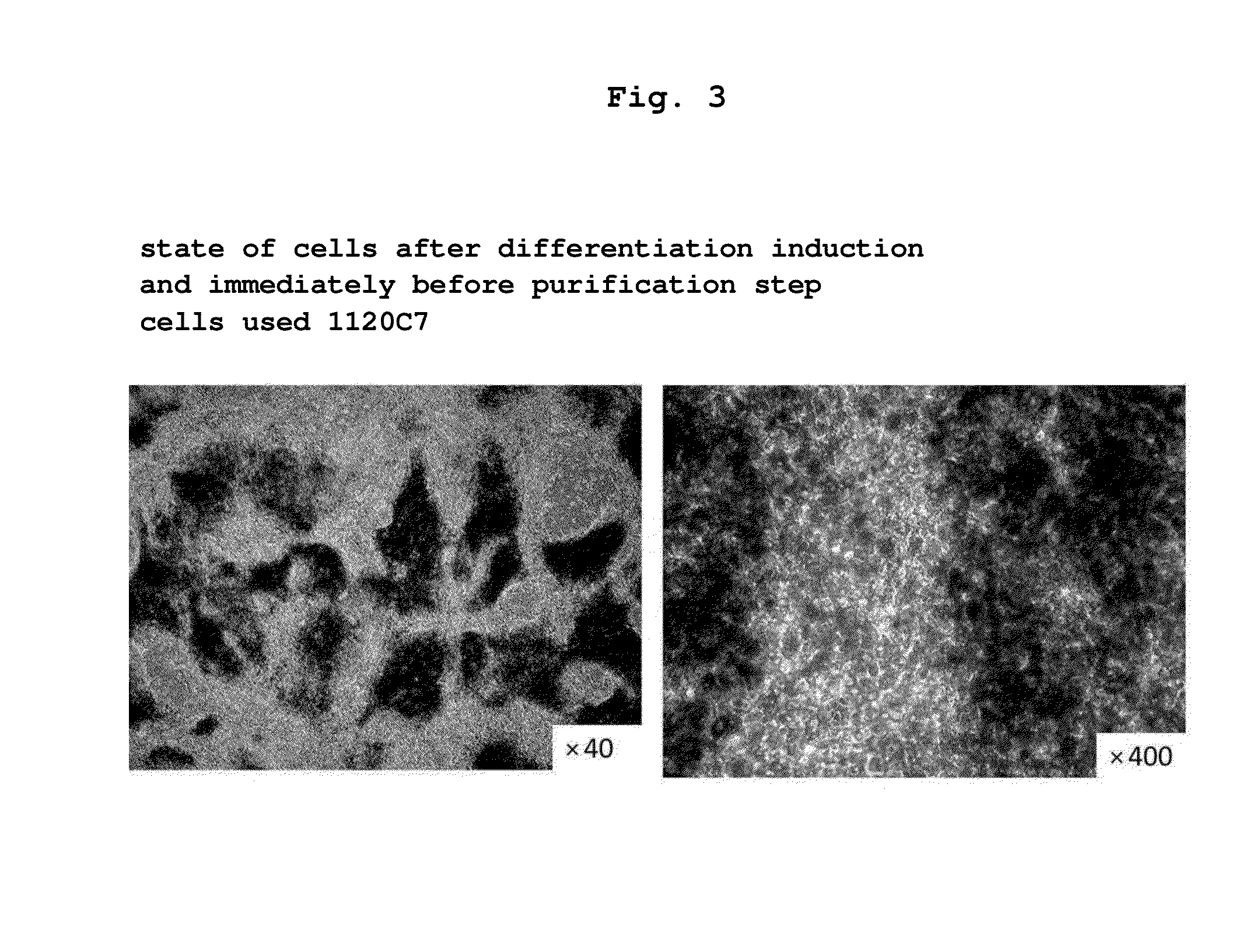 Method for purification of retinal pigment epithelial cells
