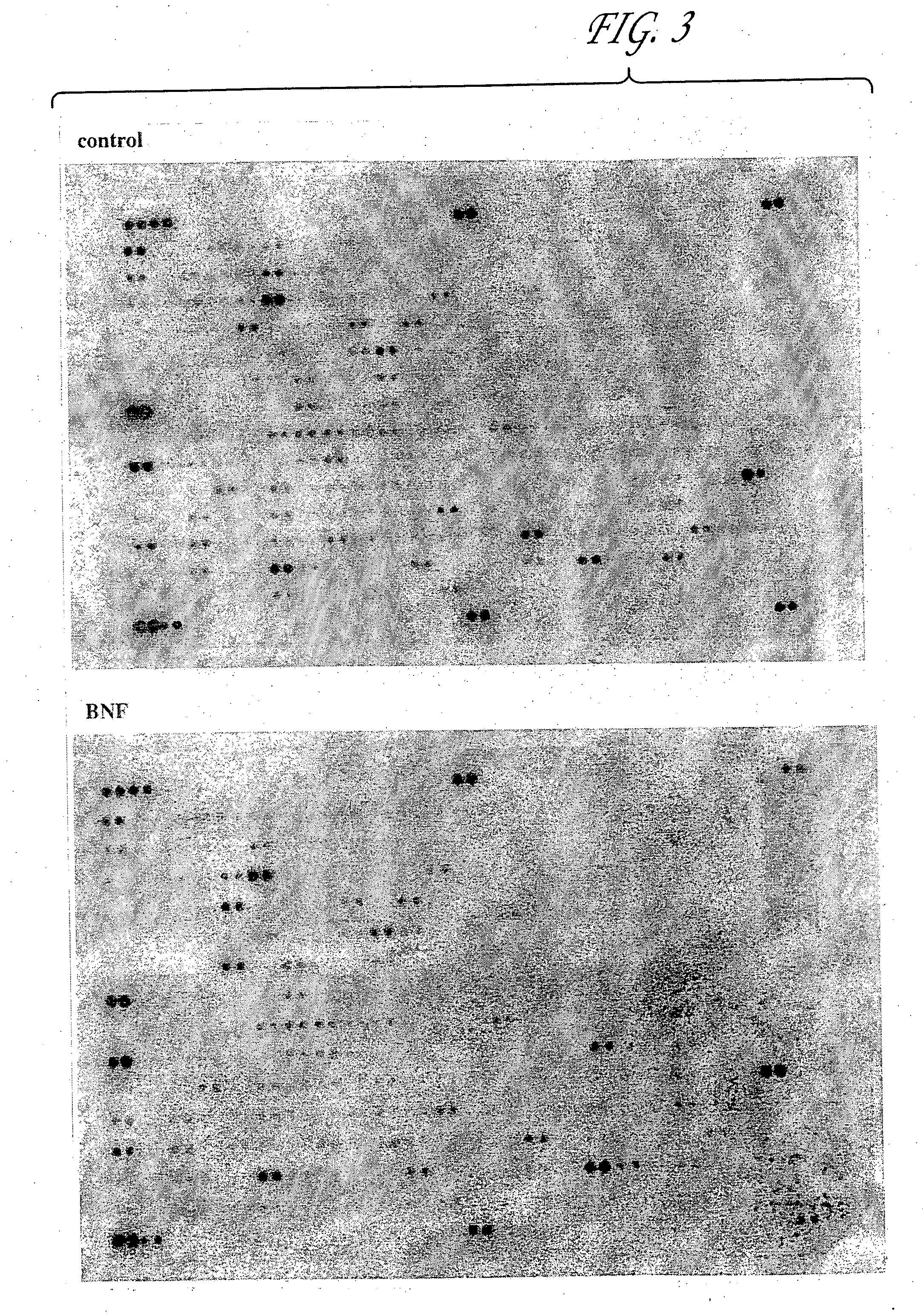 Compositions and methods for protecting cells during cancer chemotherapy and radiotherapy
