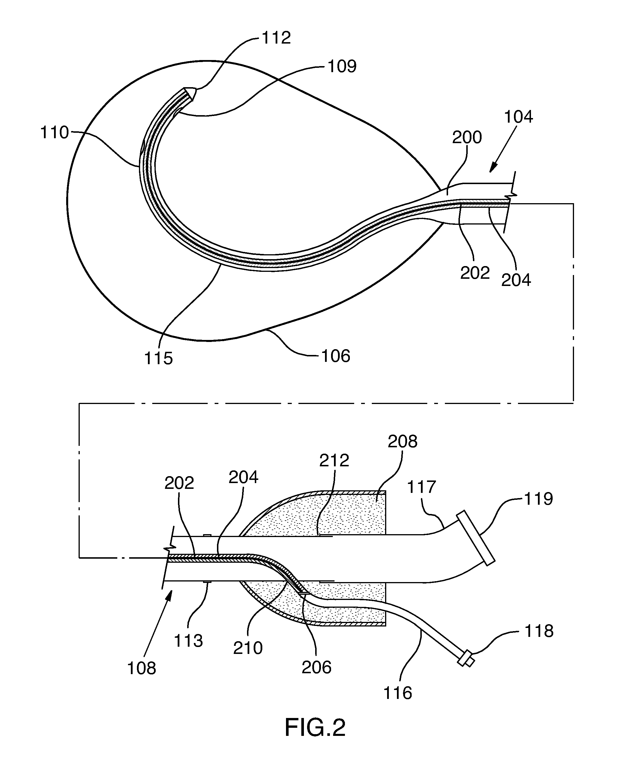 Method of surgical perforation via the delivery of energy