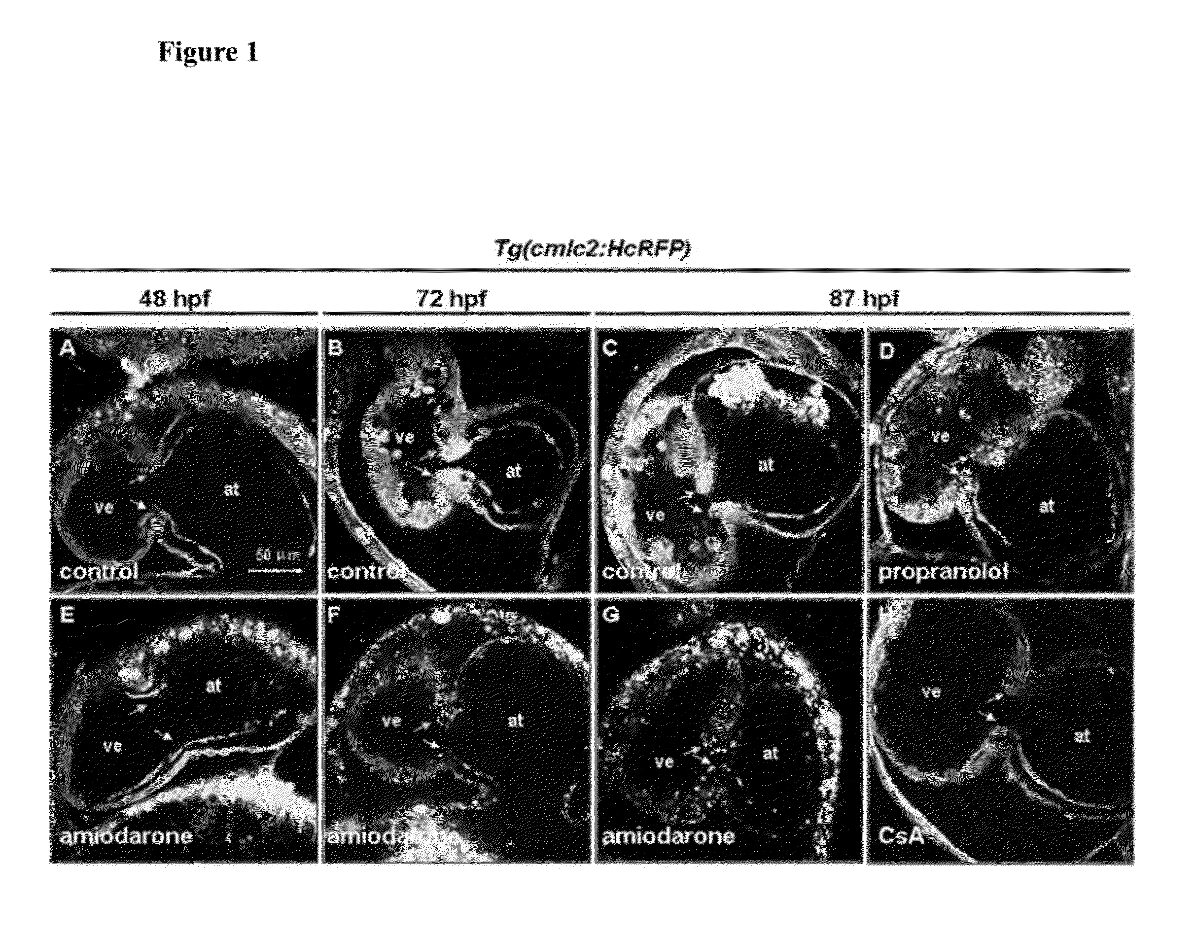 Method for inhibiting cancer metastasis by amiodarone