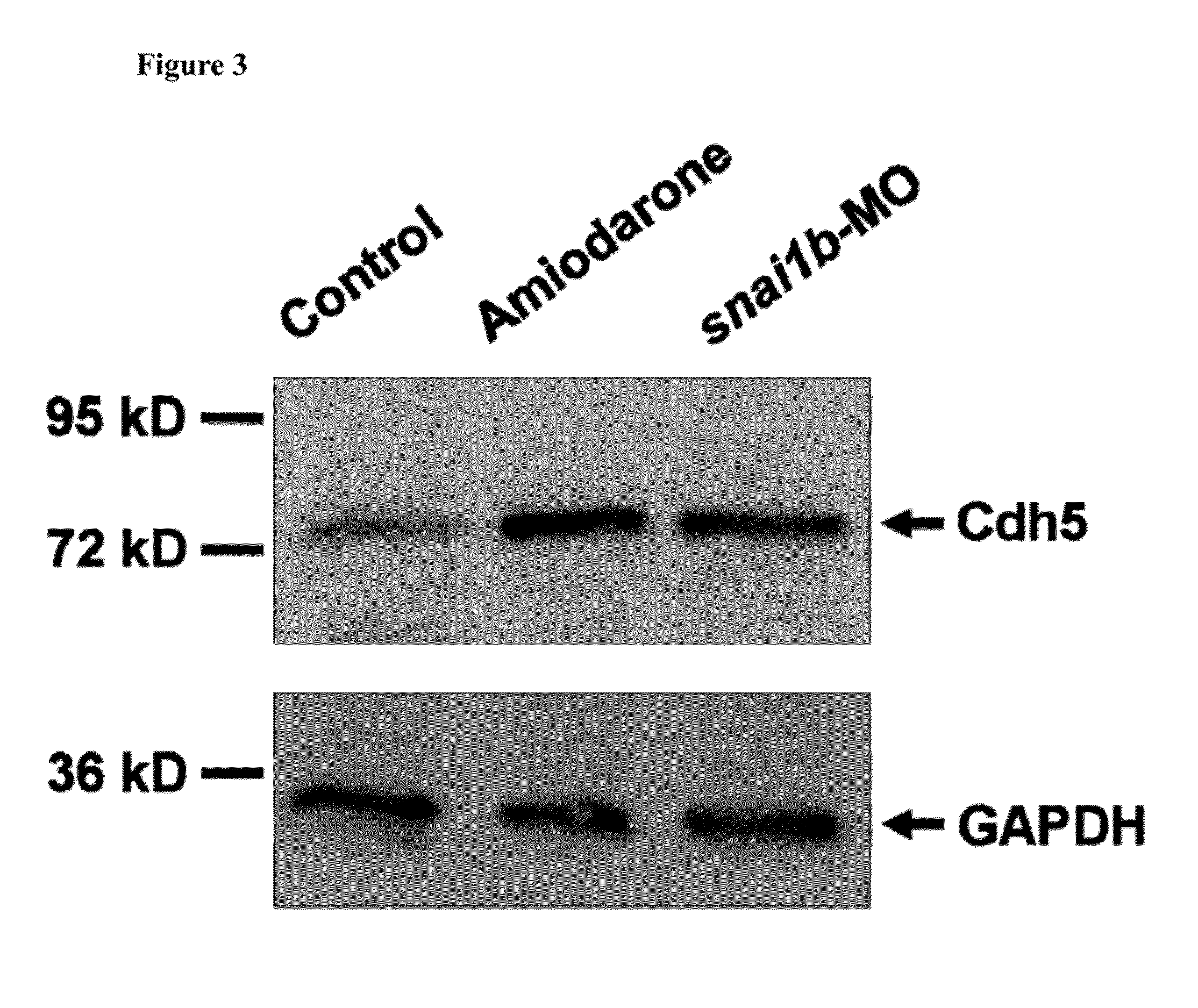 Method for inhibiting cancer metastasis by amiodarone