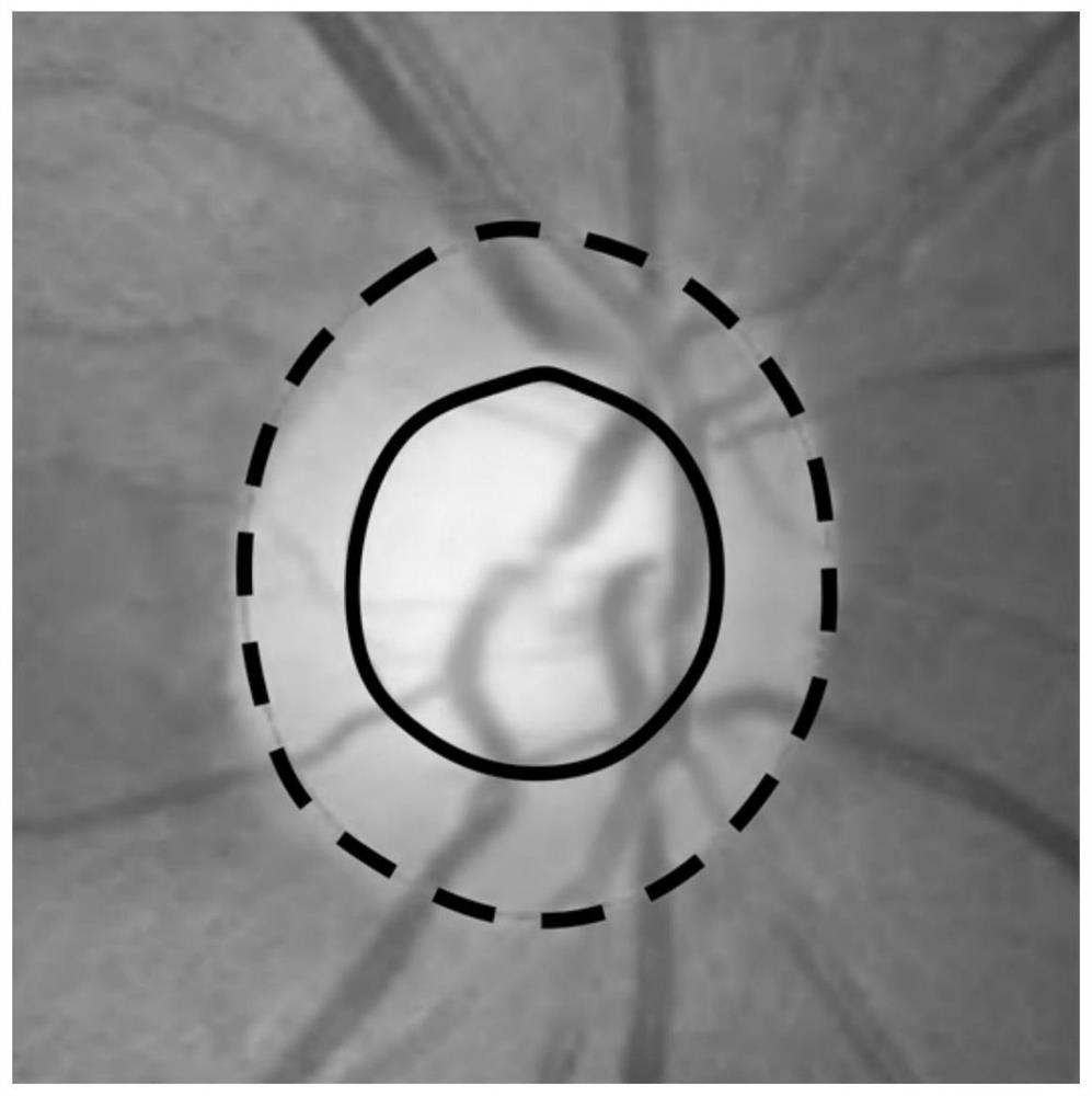 Visual cup and optic disc segmentation method based on depth level set learning