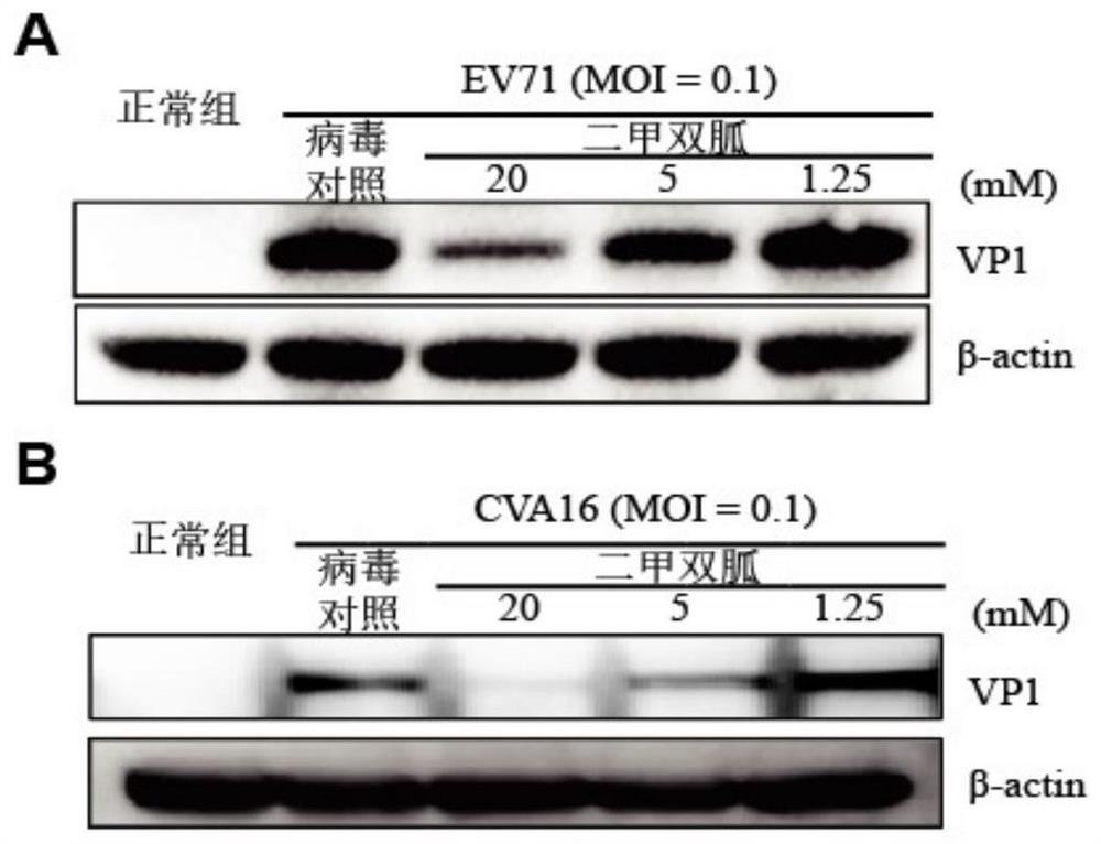 Application of metformin in preparation of medicine for treating hand-foot-and-mouth disease