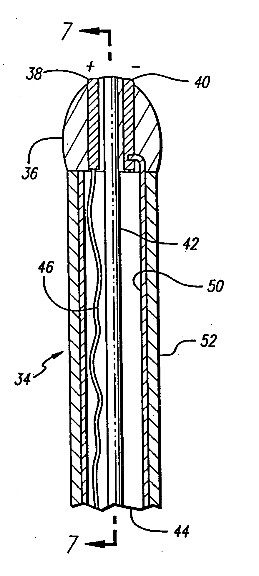 Method for treating venous insufficiency using directionally applied energy