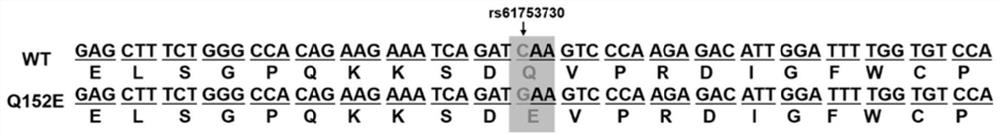 Method for constructing Fzd6-Q152E site-directed mutagenesis mouse model based on CRISPR/Cas9 and application