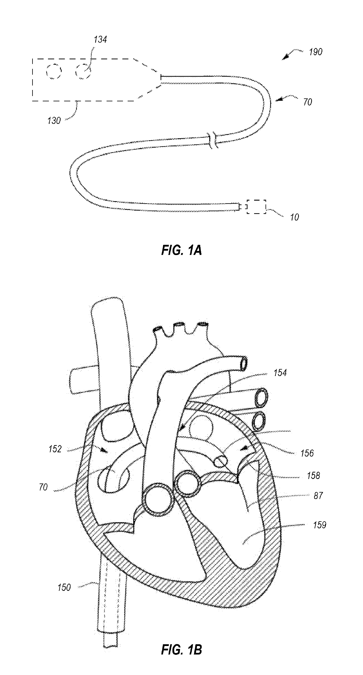 System and methods for delivering and deploying an artificial heart valve within the mitral annulus