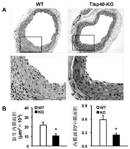 Function of transcription induction spermiogenesis gene 40(Tisp40) in treatment of angiostenosis after damage and application thereof