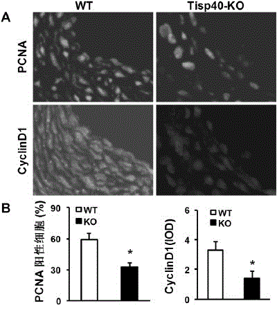 Function of transcription induction spermiogenesis gene 40(Tisp40) in treatment of angiostenosis after damage and application thereof