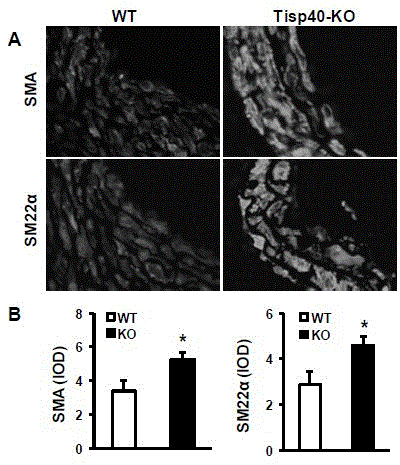 Function of transcription induction spermiogenesis gene 40(Tisp40) in treatment of angiostenosis after damage and application thereof