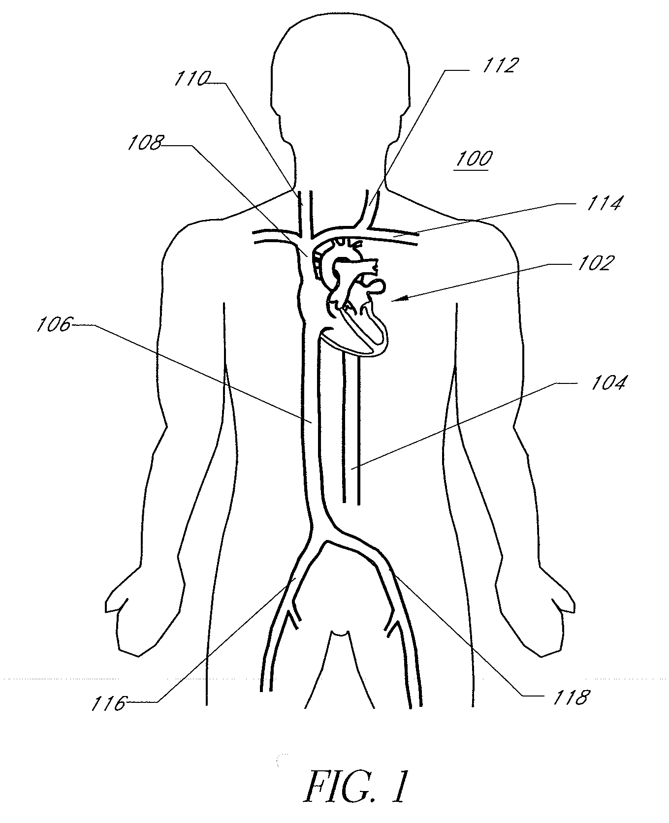 Expandable trans-septal sheath