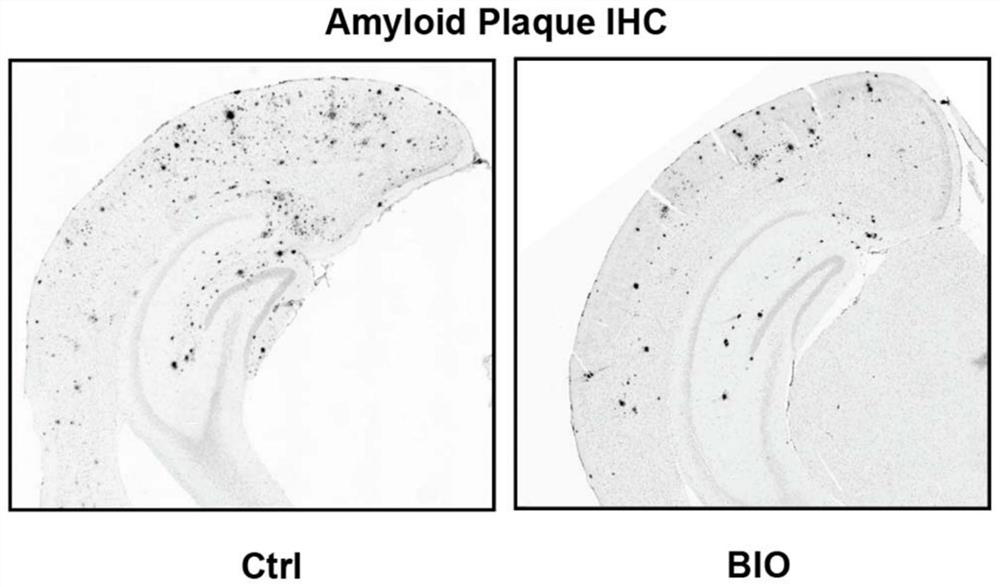 Small molecule compound and application thereof in preparation of related products for treating or preventing Alzheimer's disease