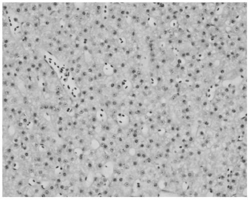 A Feed for Preventing Abnormal Fat Deposition in Liver Tissue of Grass Carp