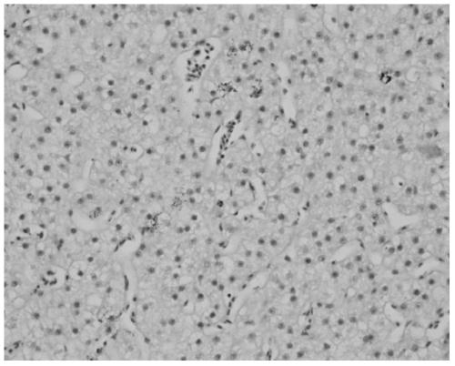 A Feed for Preventing Abnormal Fat Deposition in Liver Tissue of Grass Carp