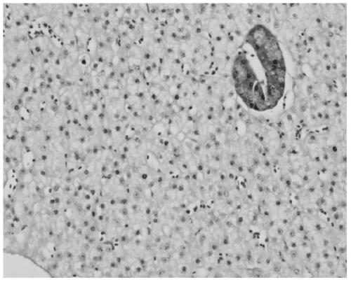 A Feed for Preventing Abnormal Fat Deposition in Liver Tissue of Grass Carp