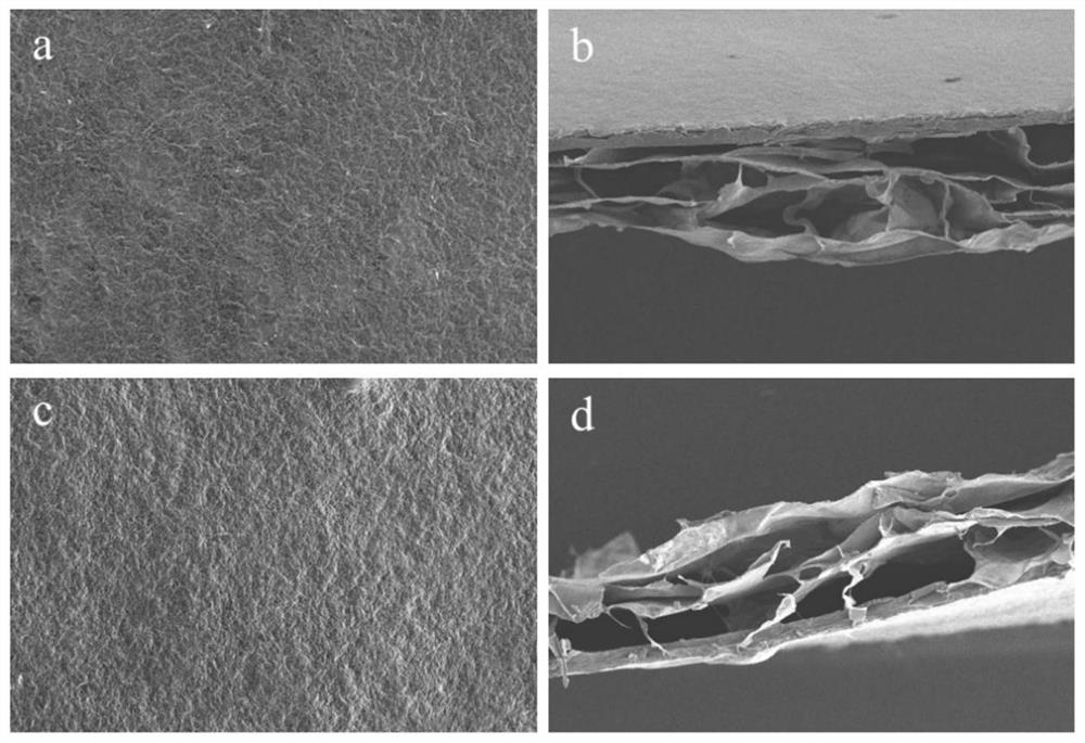 A degradable, anti-adhesion double-layer dura mater patch and its preparation method