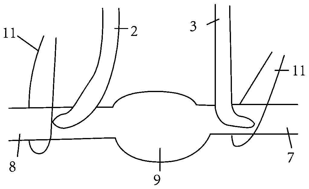 Balloon vena cava cannula