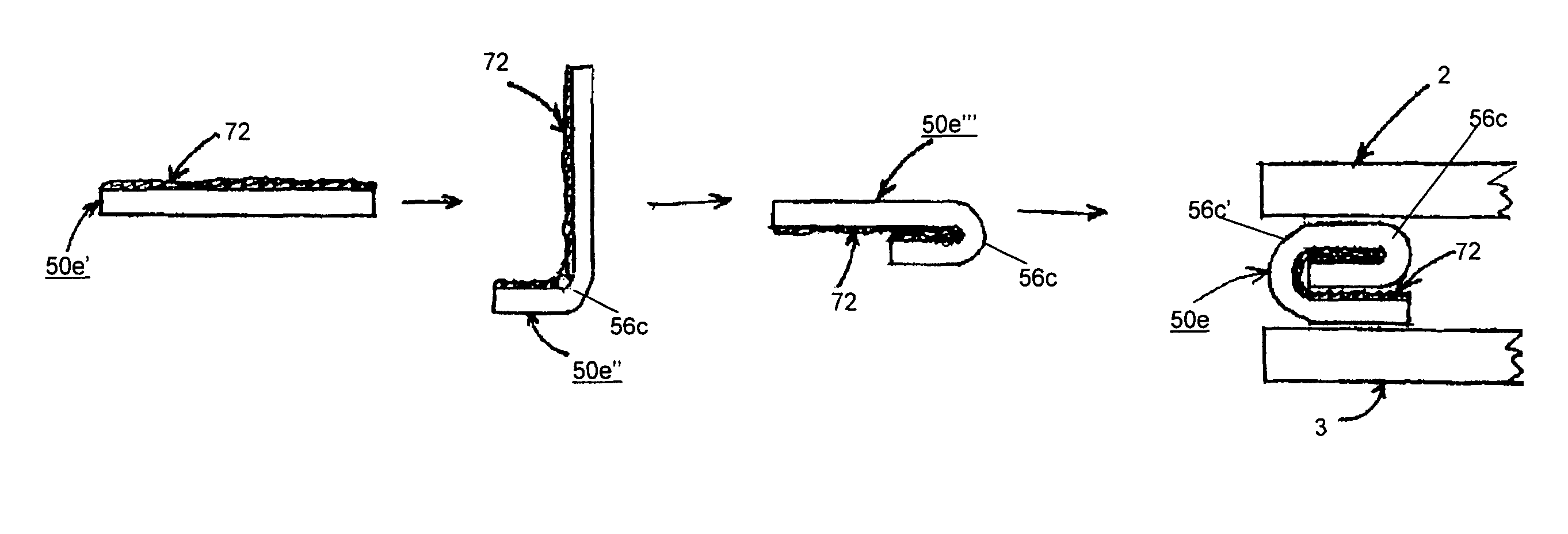 Metal-inclusive edge seal for vacuum insulating glass unit, and/or method of making the same