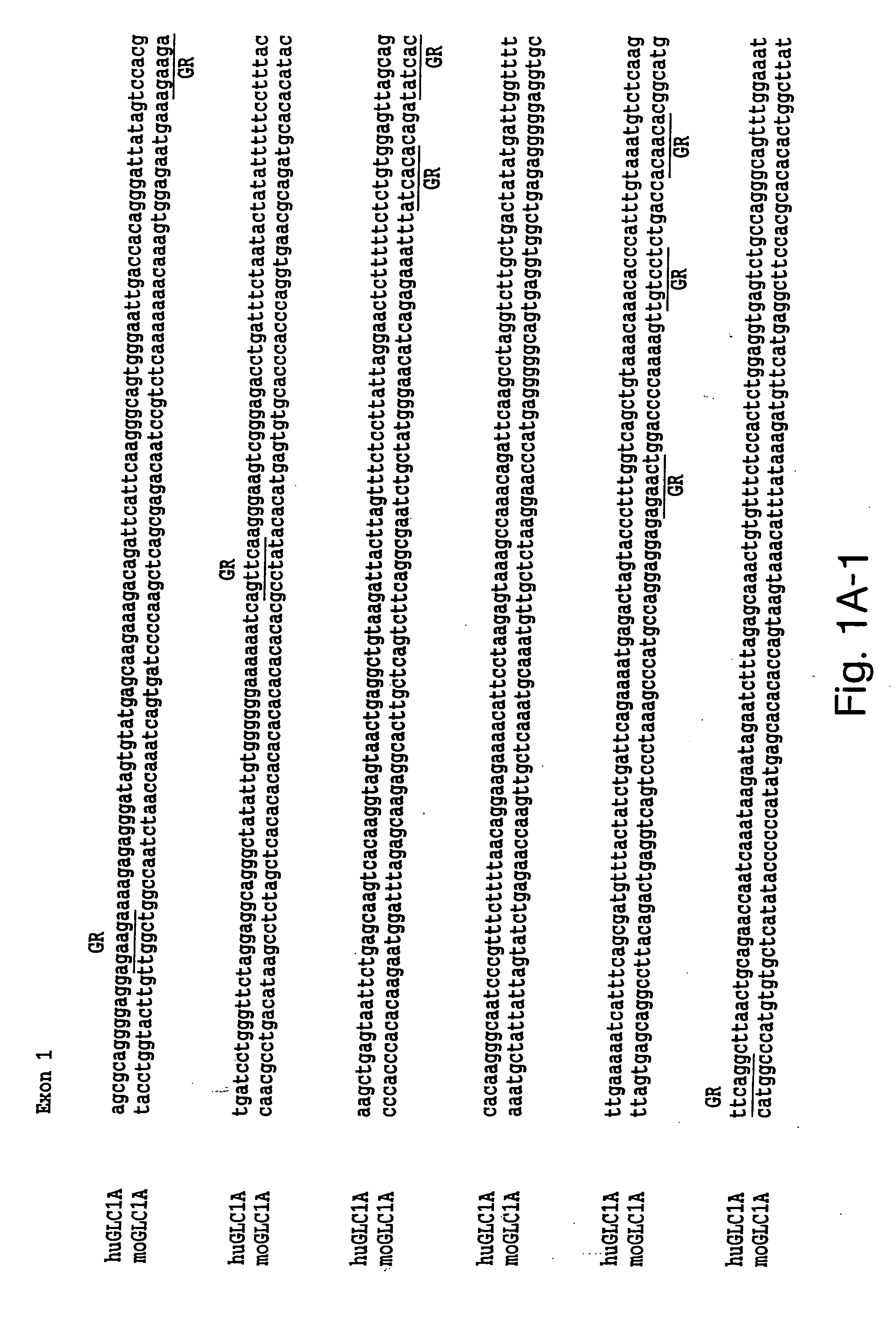 Glaucoma therapeutics and diagnostics