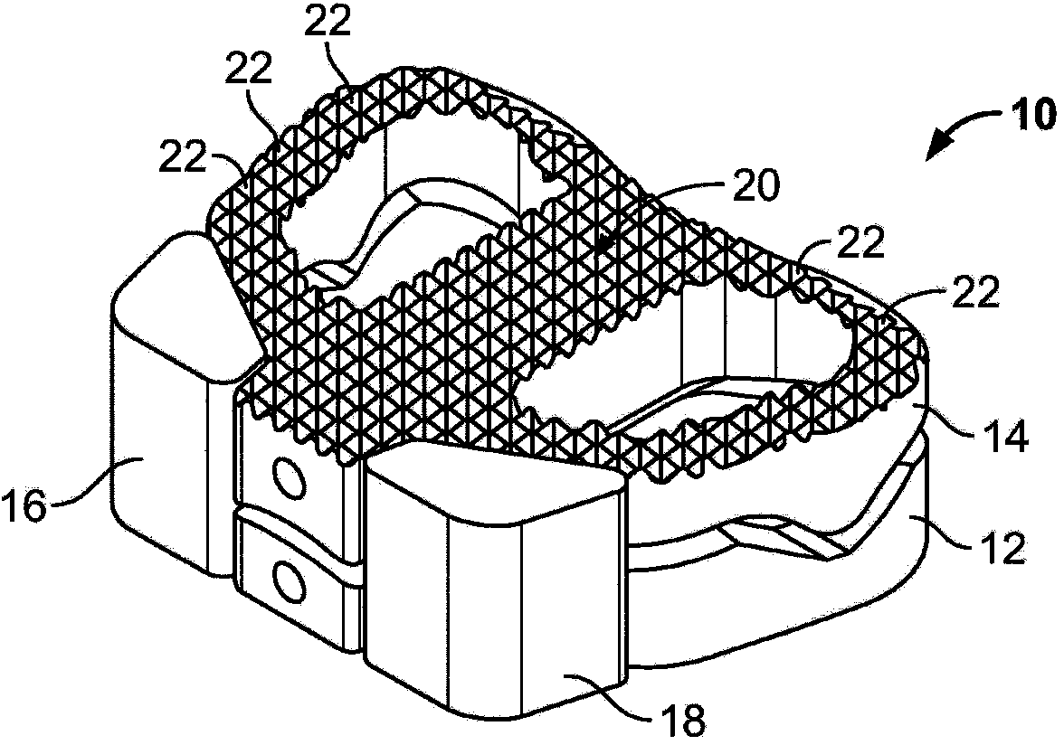 Spinal implant, instrument for preparation and method of use