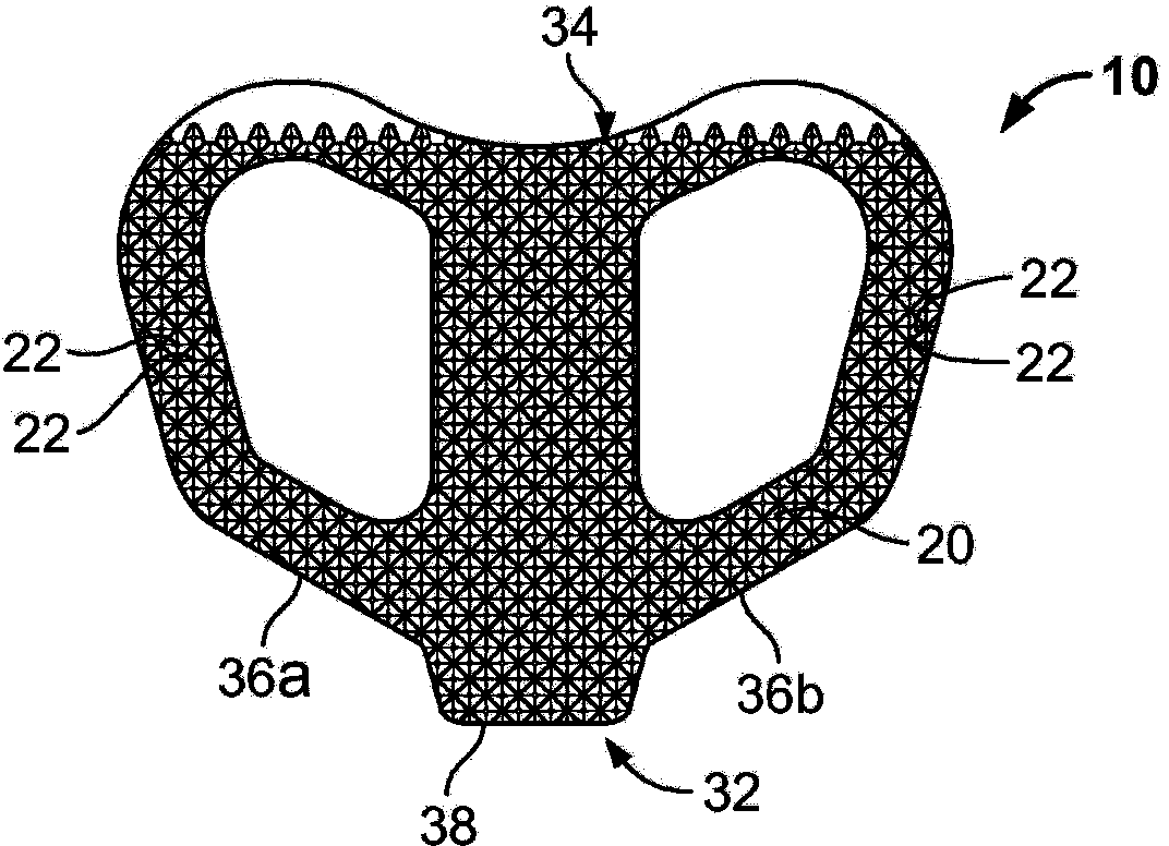 Spinal implant, instrument for preparation and method of use