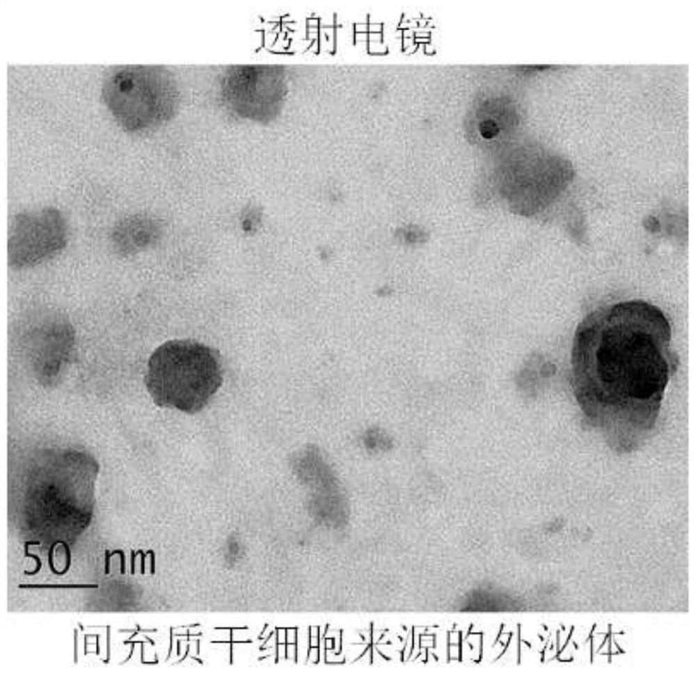 A preparation method and application of oral microspheres loaded with mscs-derived exosomes