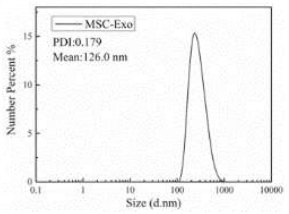 A preparation method and application of oral microspheres loaded with mscs-derived exosomes