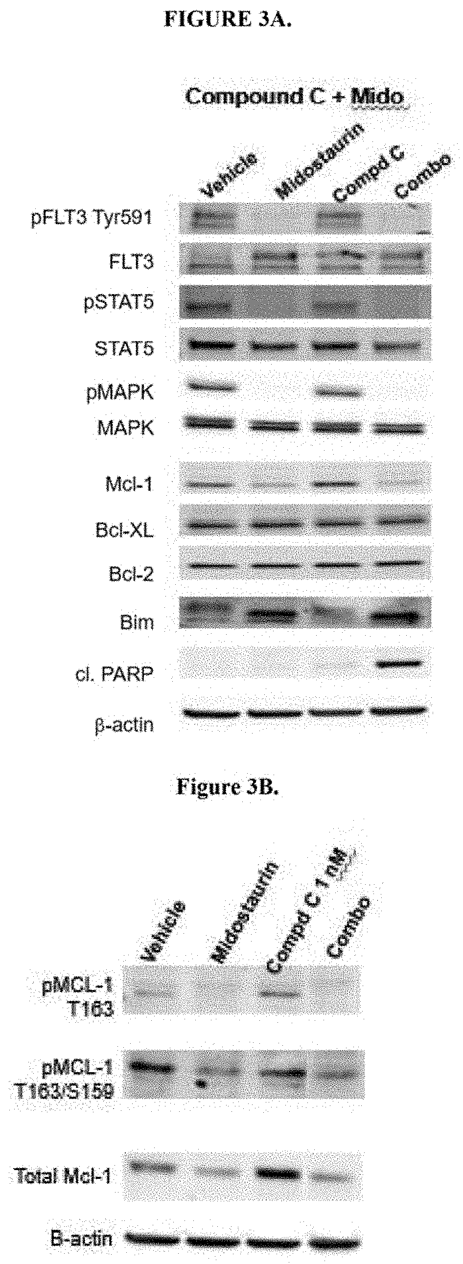 Combination of a mcl-1 inhibitor and midostaurin, uses and pharmaceutical compositions thereof